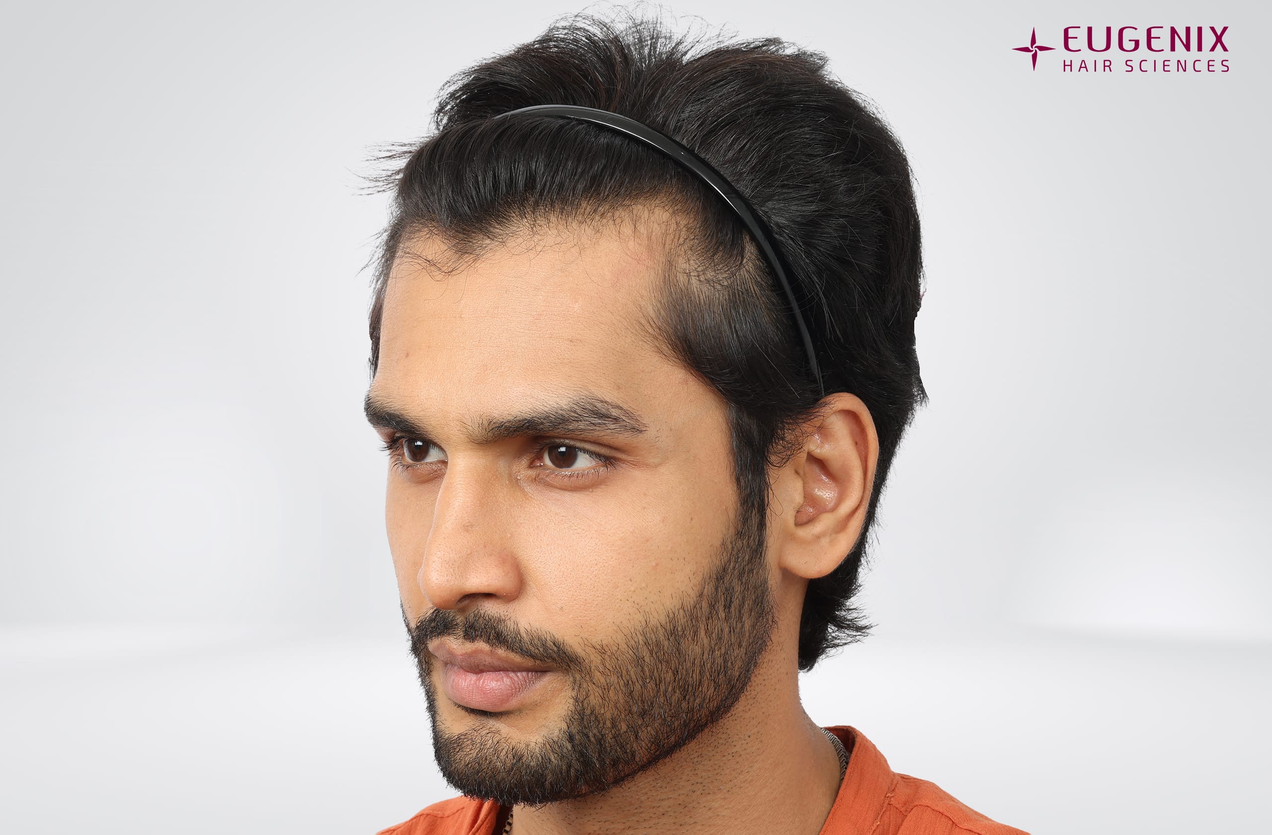 Rohit Khandelwal Before Right copy