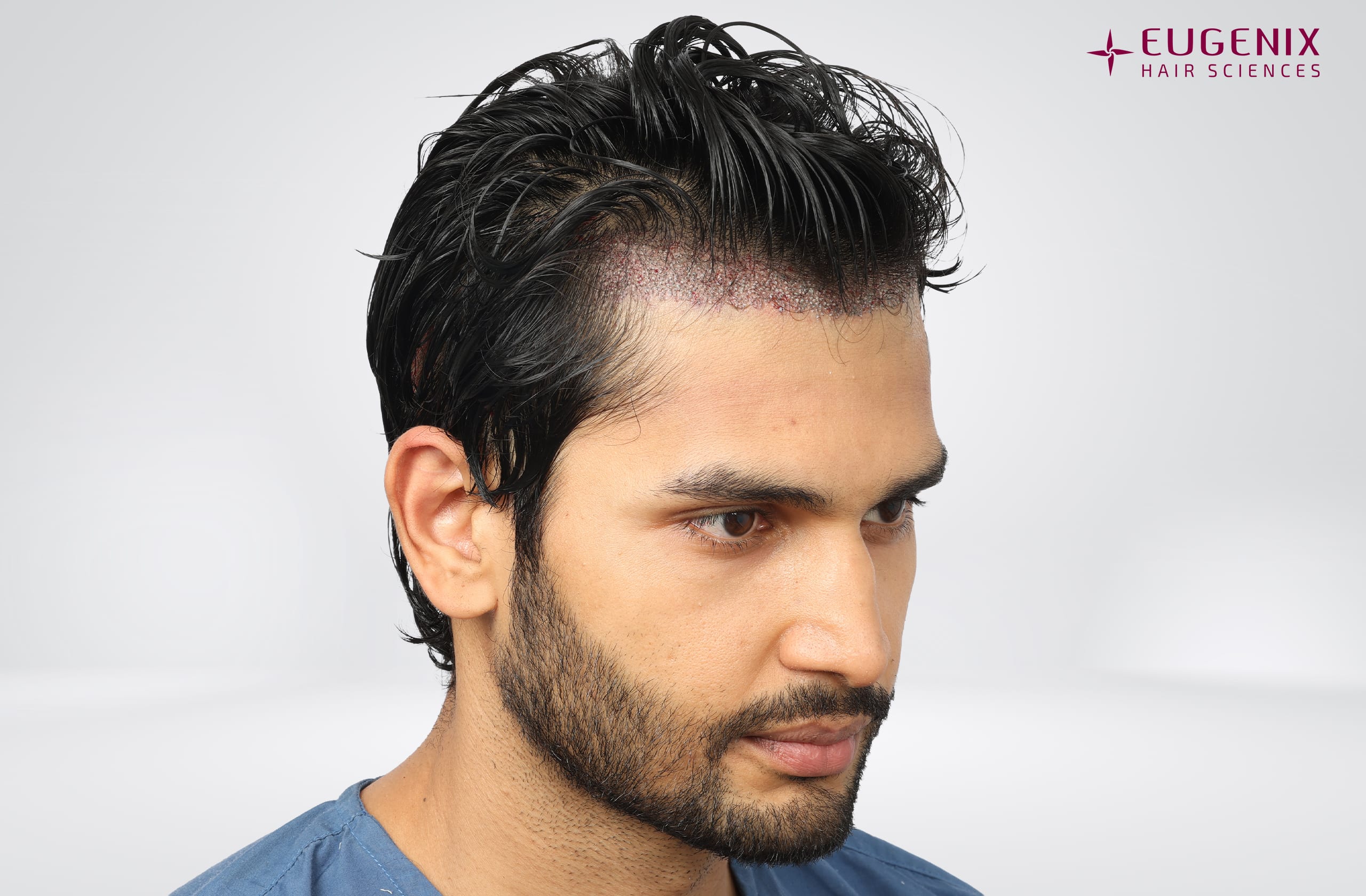 Rohit Khandelwal Post-op Left copy