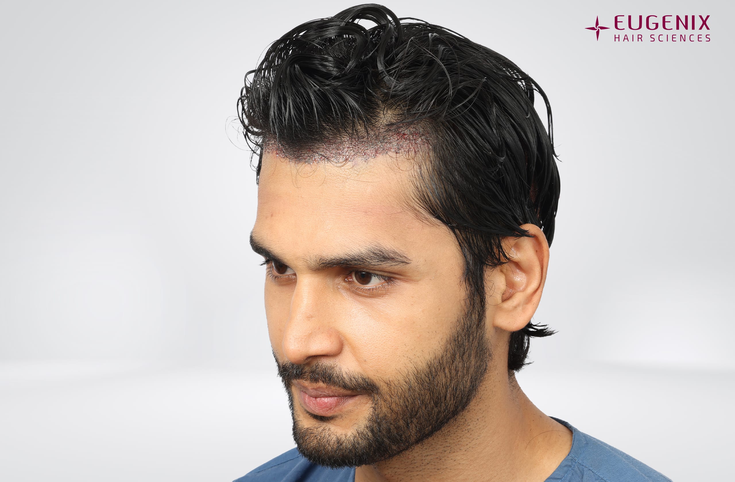 Rohit Khandelwal Post-op Right copy
