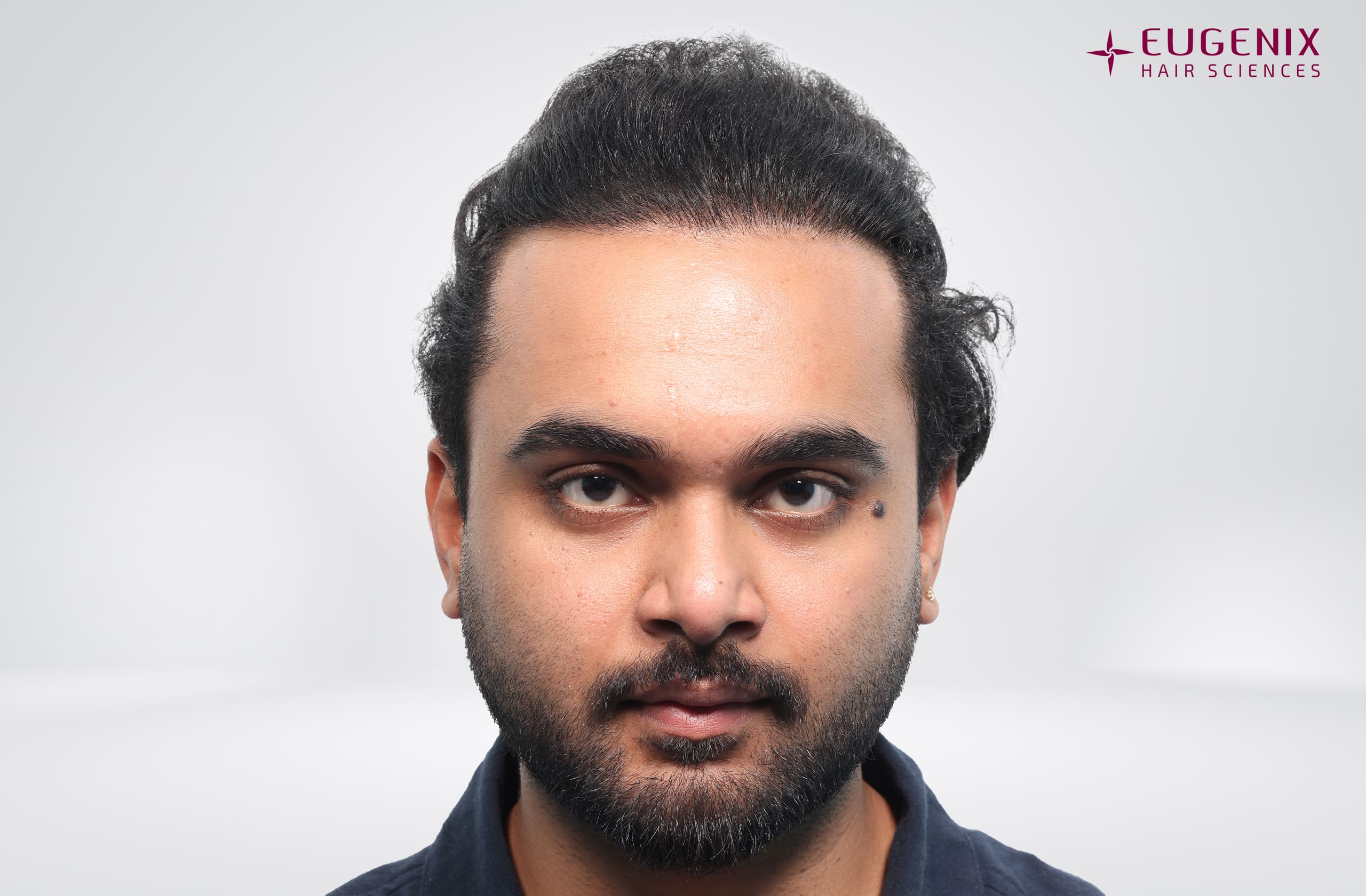Suyash Srivastava After Front copy