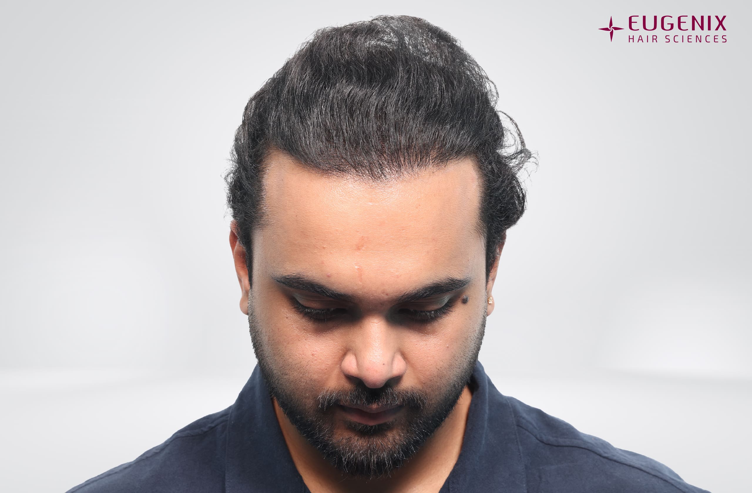 Suyash Srivastava After Head Down copy