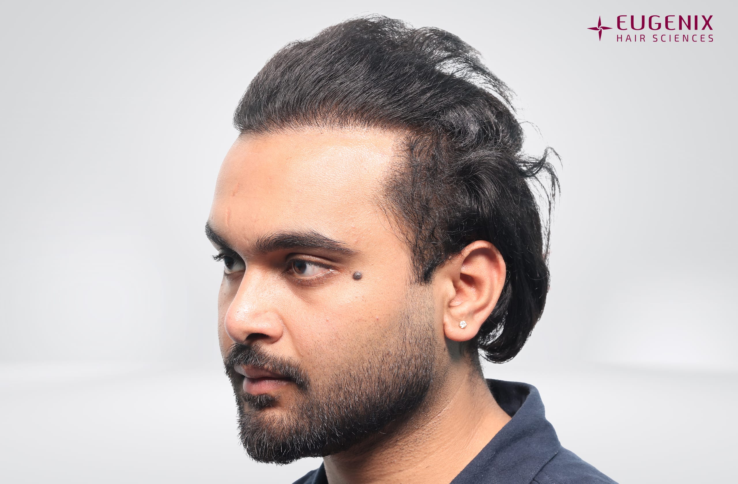Suyash Srivastava After Right copy