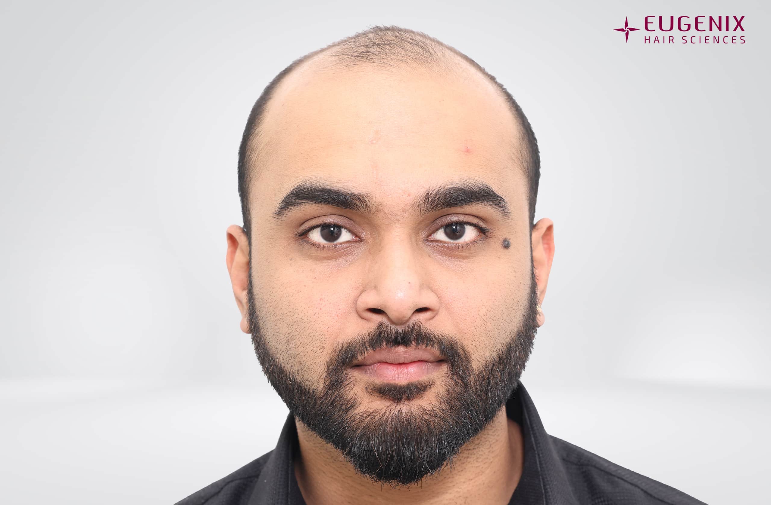 Suyash Srivastava Before Front copy