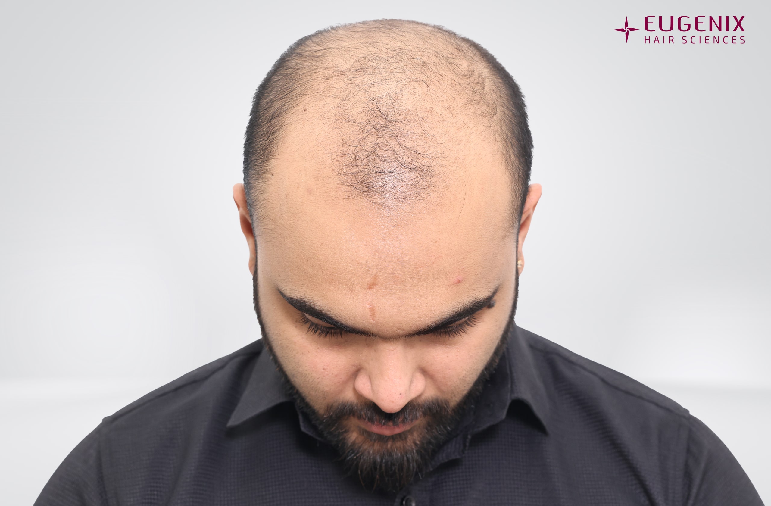 Suyash Srivastava Before Head Down copy