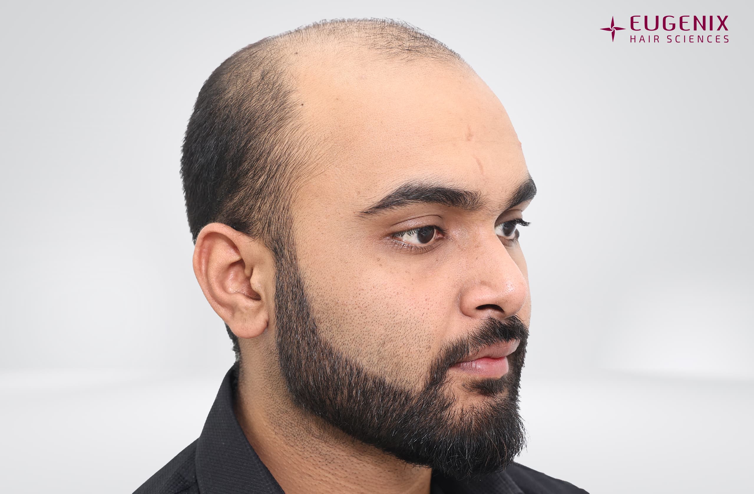 Suyash Srivastava Before Left copy