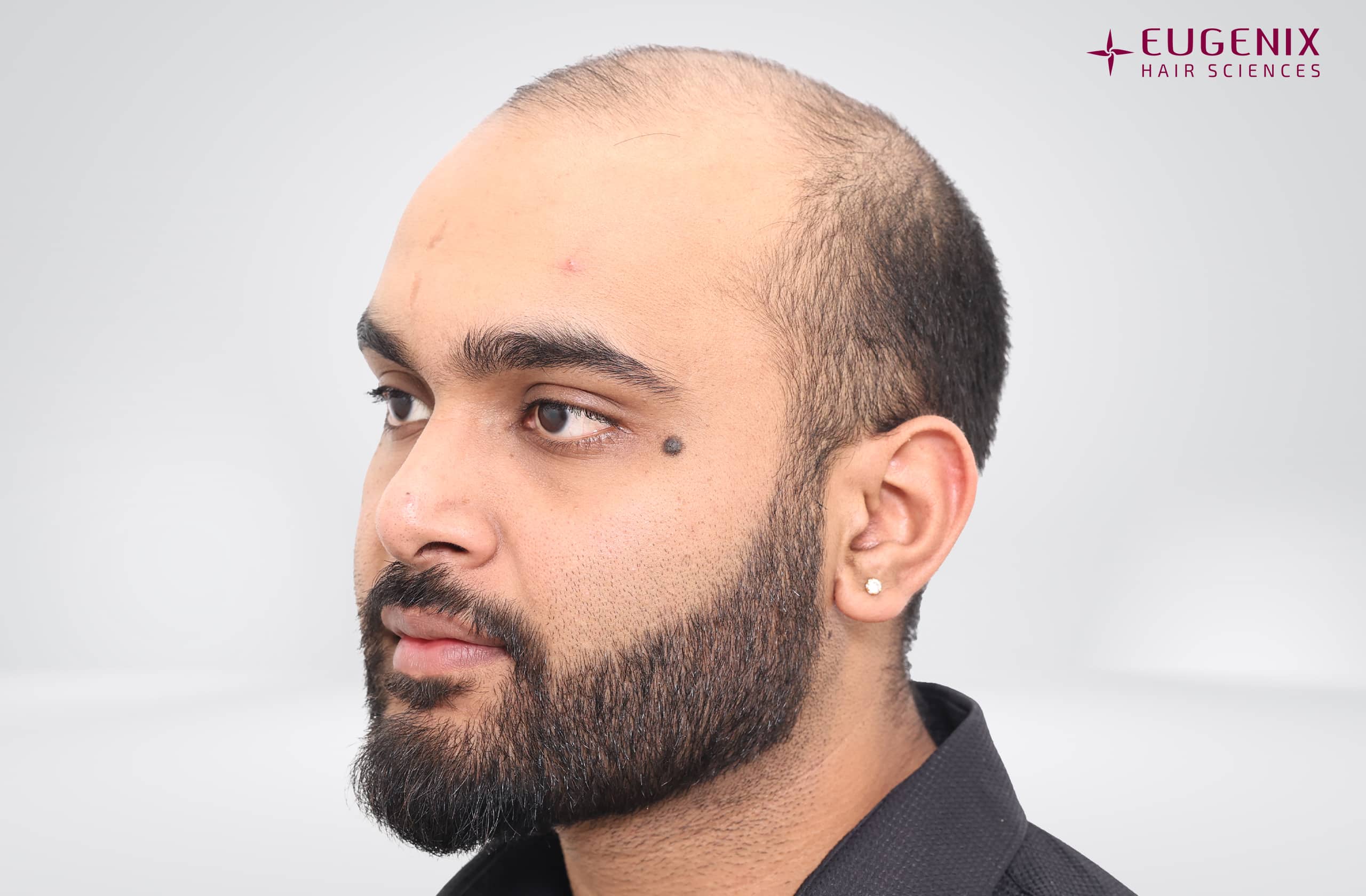 Suyash Srivastava Before Right copy
