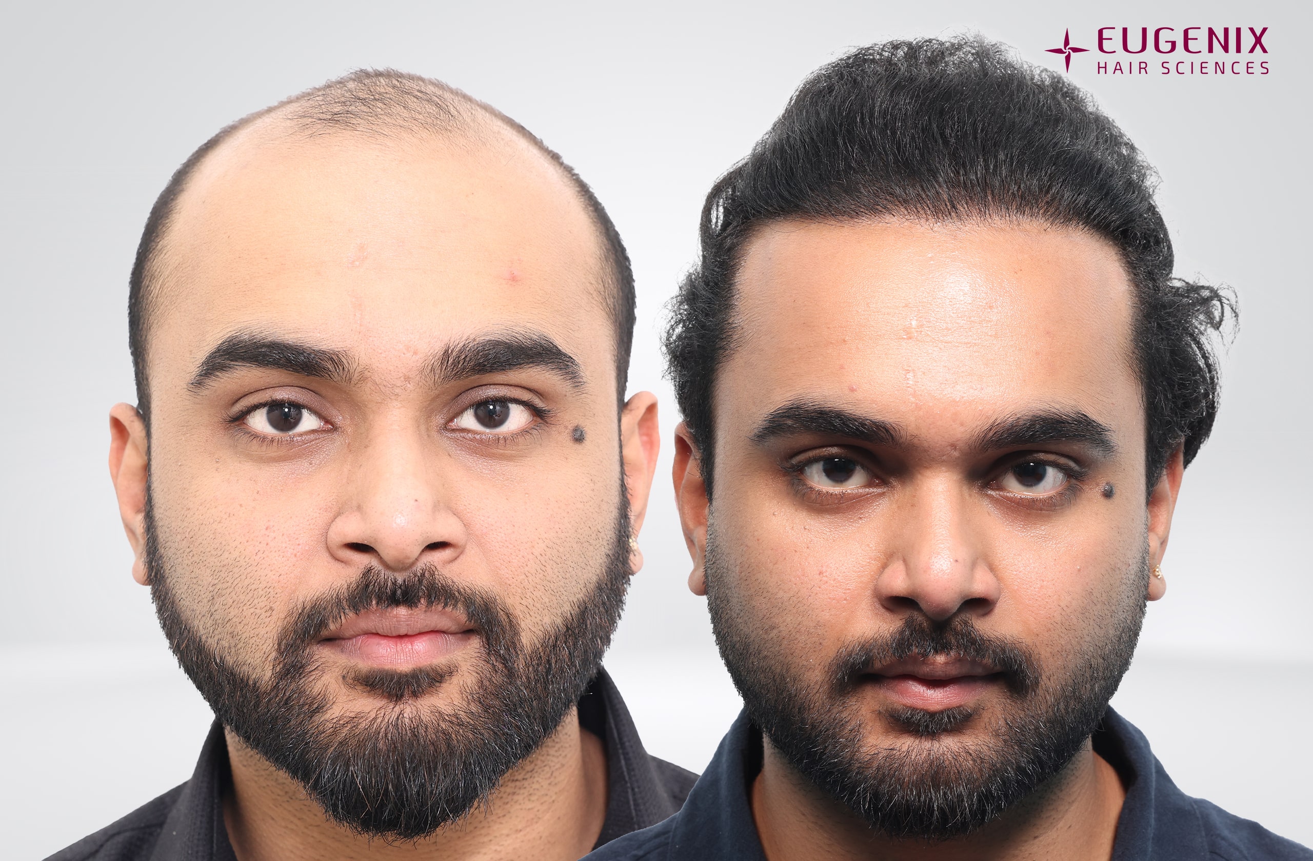 Suyash Srivastava Before and After Front copy