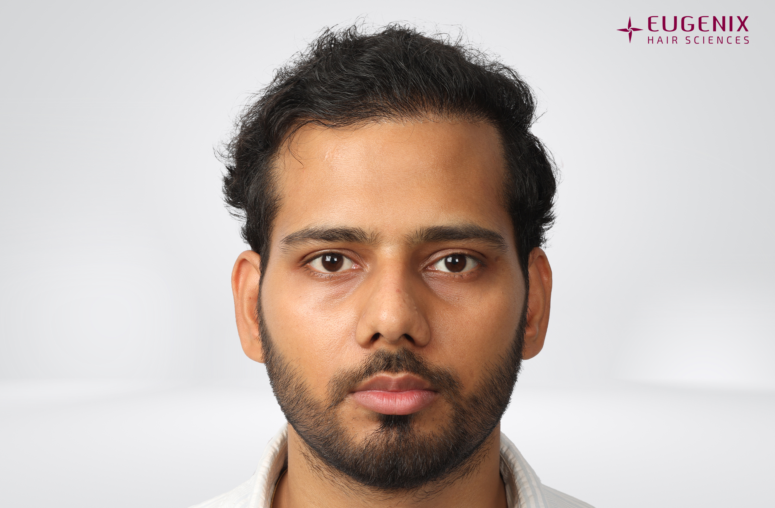 Devanshu Mishra After Front copy
