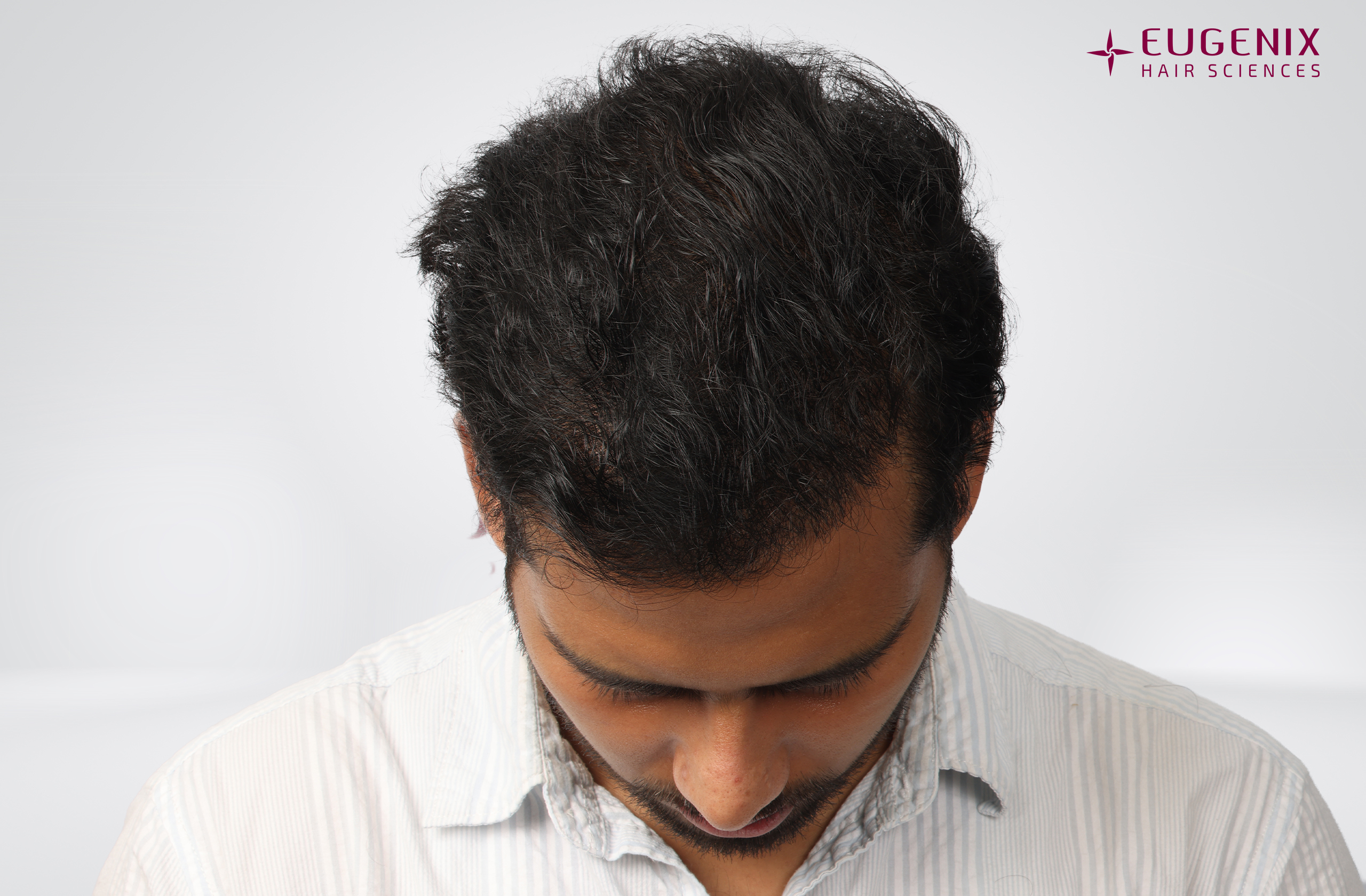 Devanshu Mishra After Head Down copy