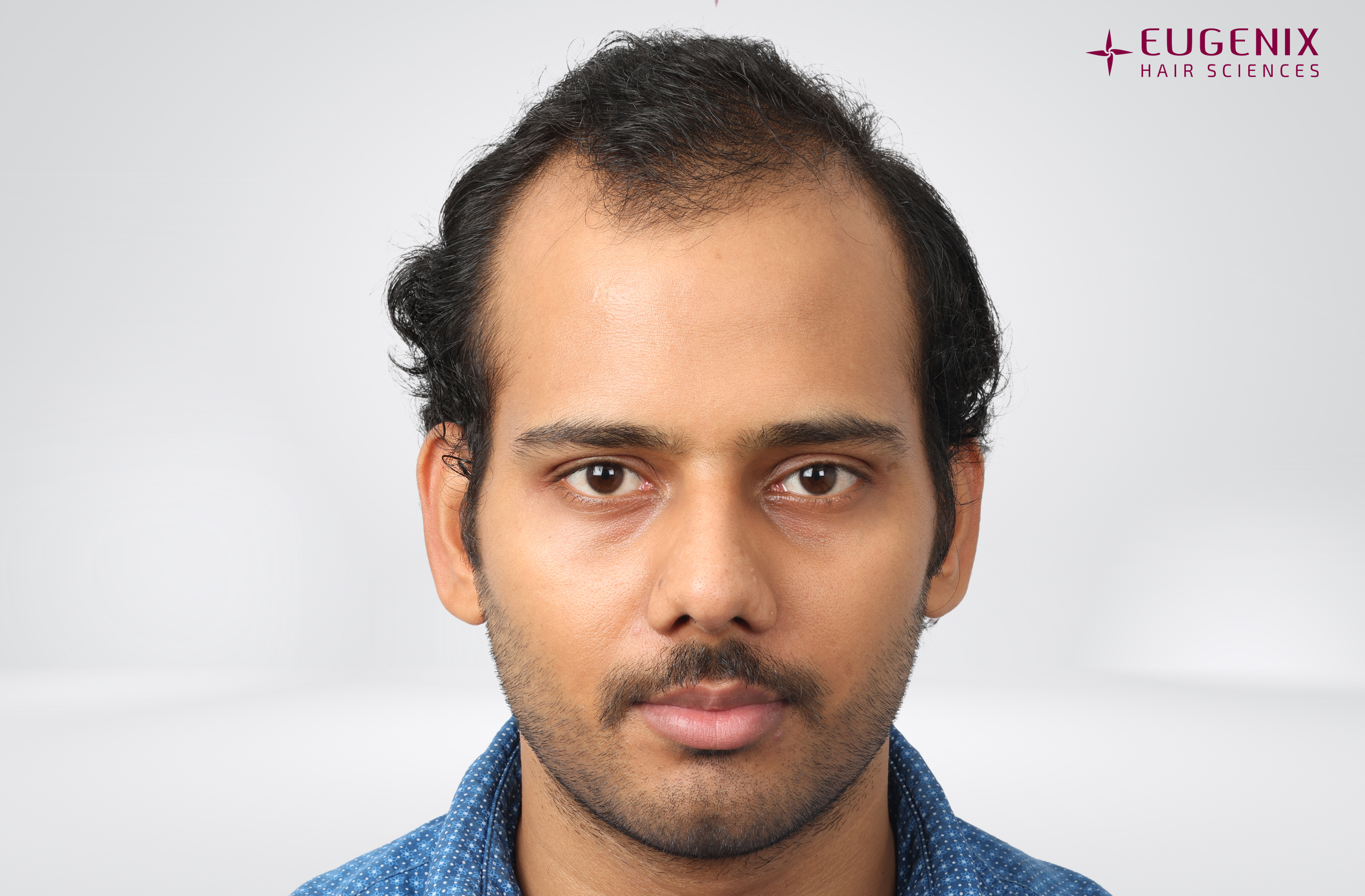 Devanshu Mishra Before Front copy
