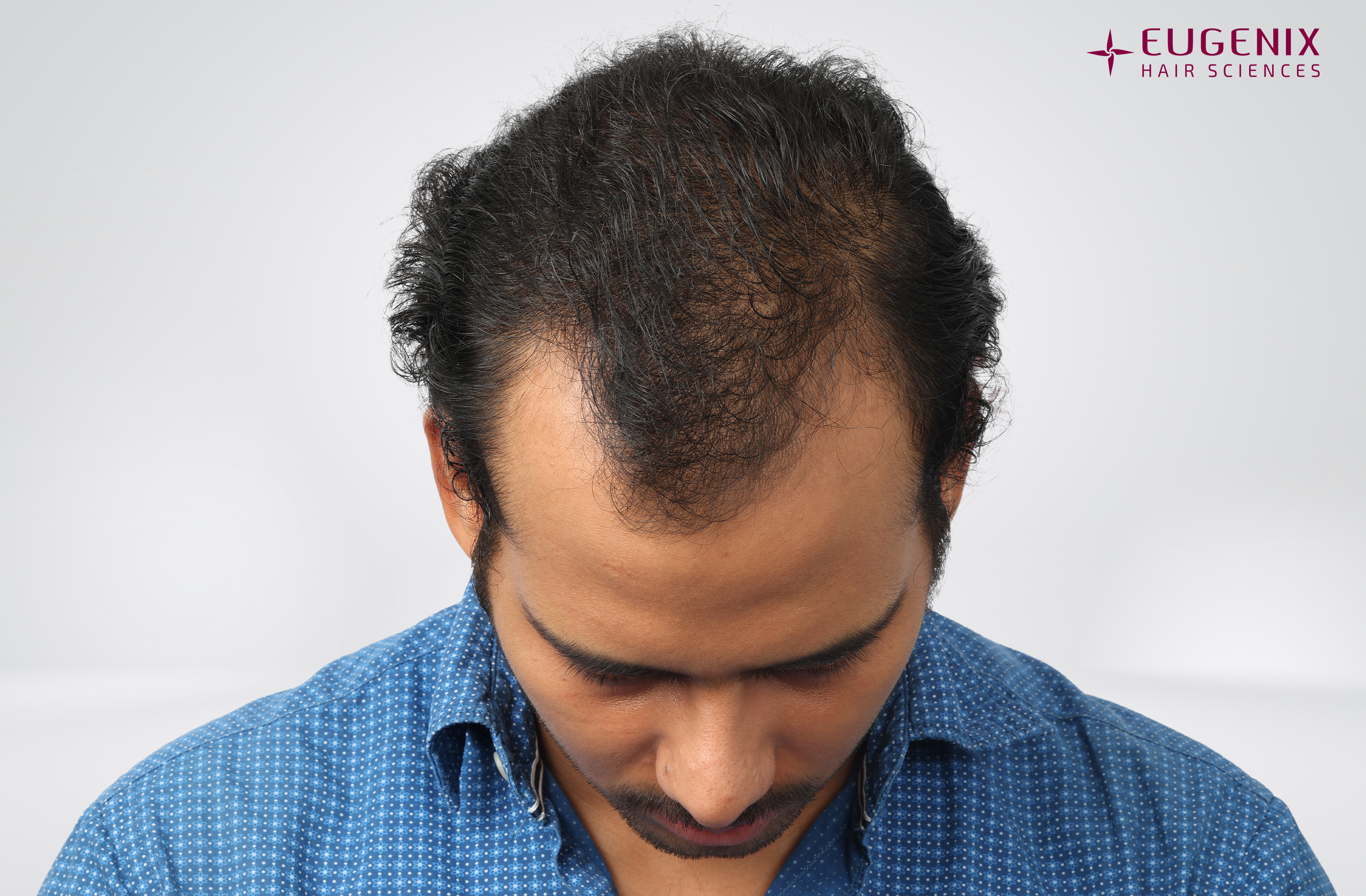 Devanshu Mishra Before Head Down copy