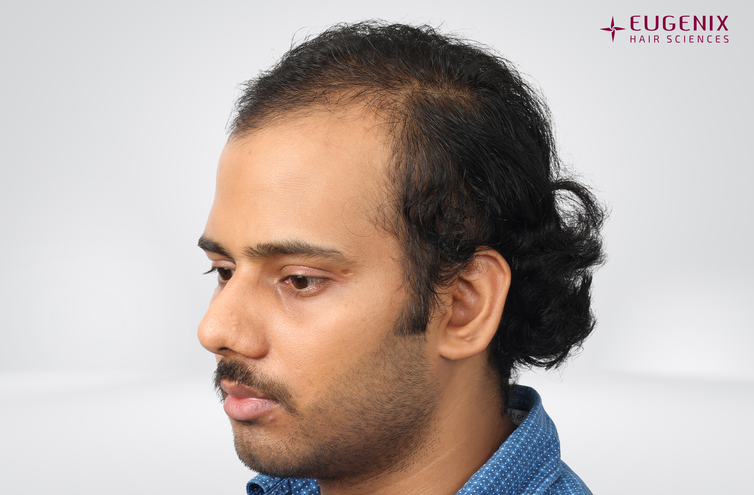 Devanshu Mishra Before Right copy