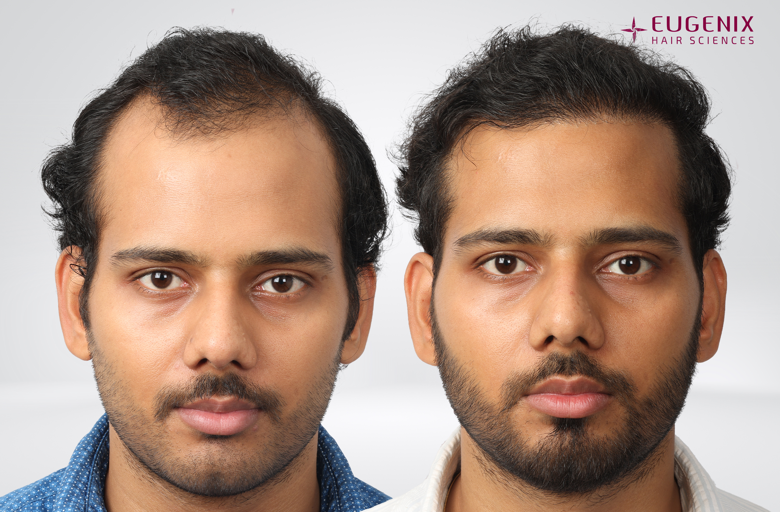 Devanshu Mishra Before and After Front copy