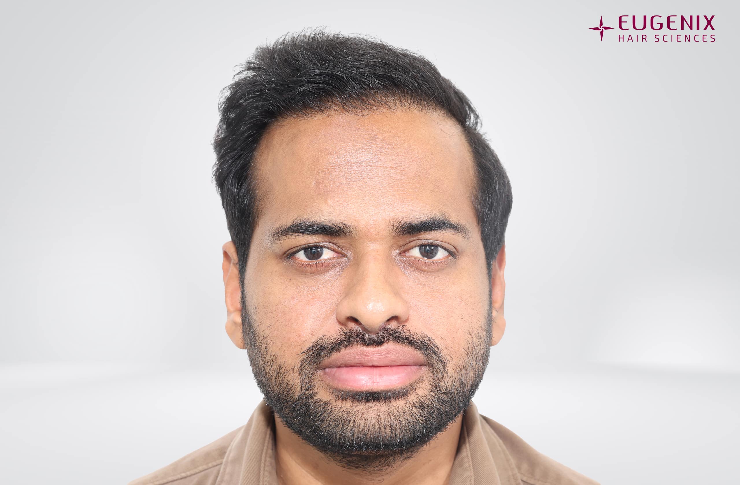 Kolanupaka Vishnu Vardhan After Front copy