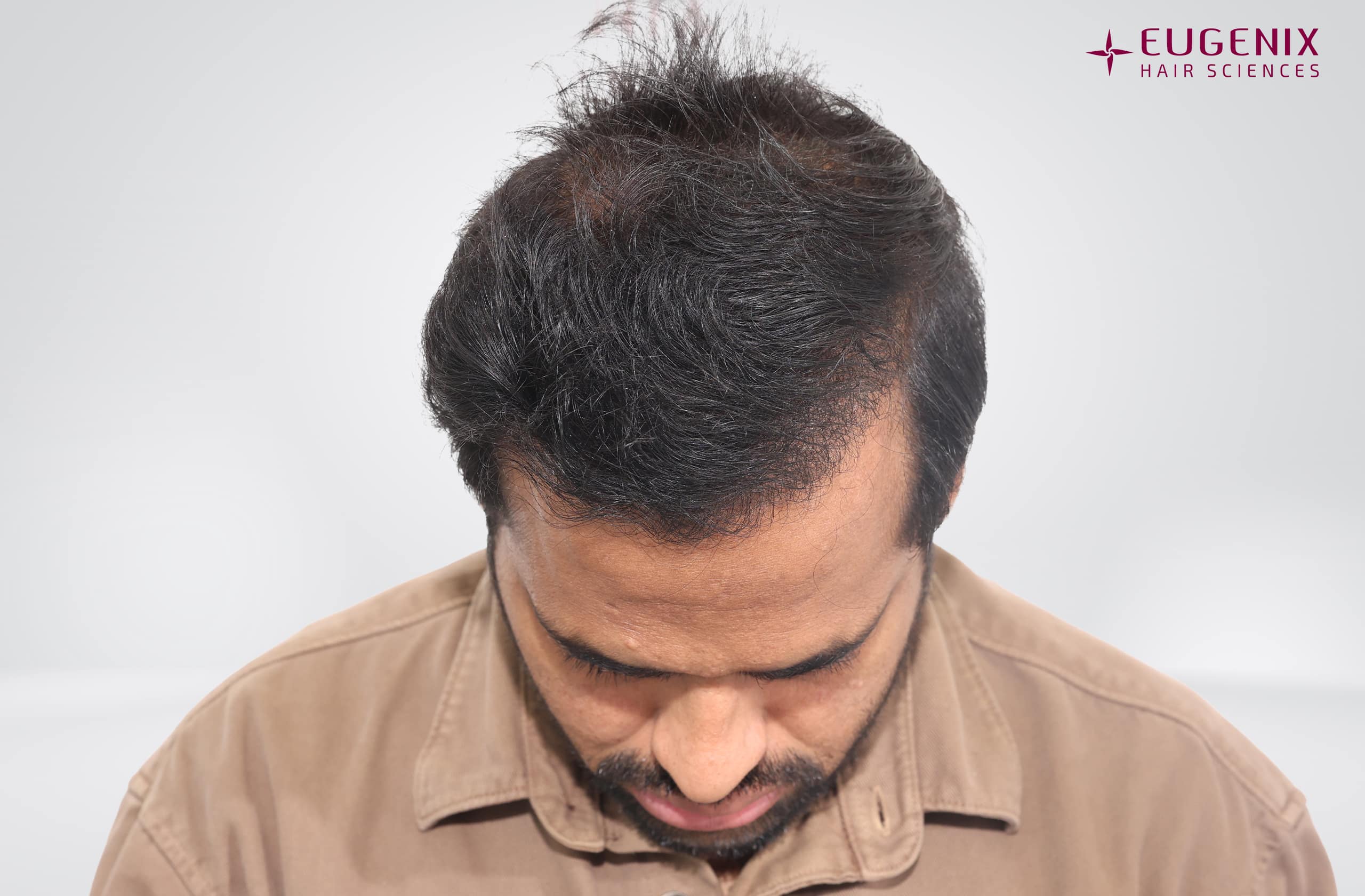 Kolanupaka Vishnu Vardhan After Head Down copy