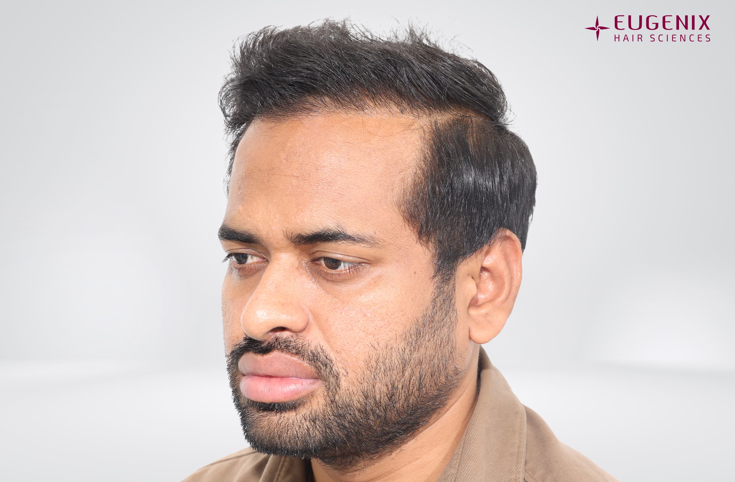 Kolanupaka Vishnu Vardhan After Right copy
