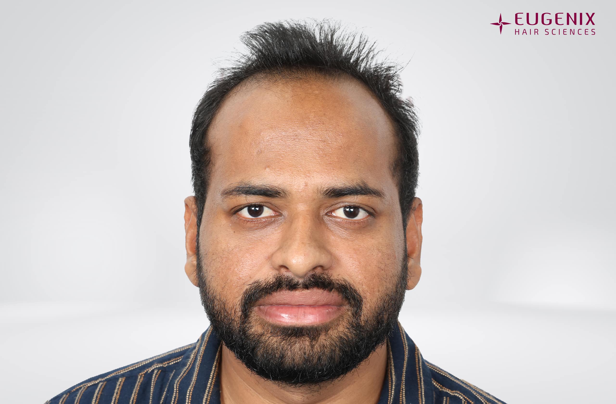 Kolanupaka Vishnu Vardhan Before Front copy
