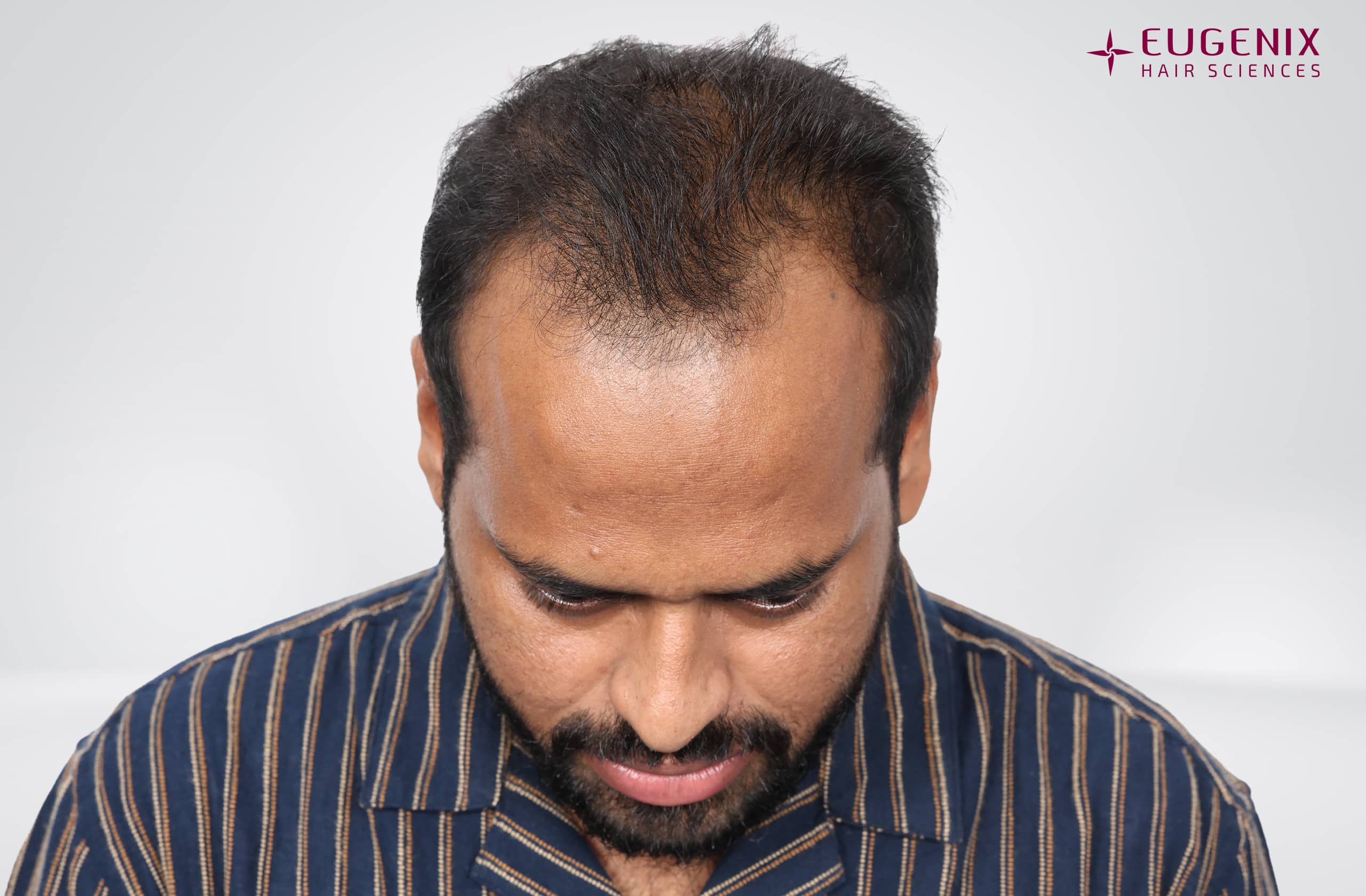 Kolanupaka Vishnu Vardhan Before Head Down copy