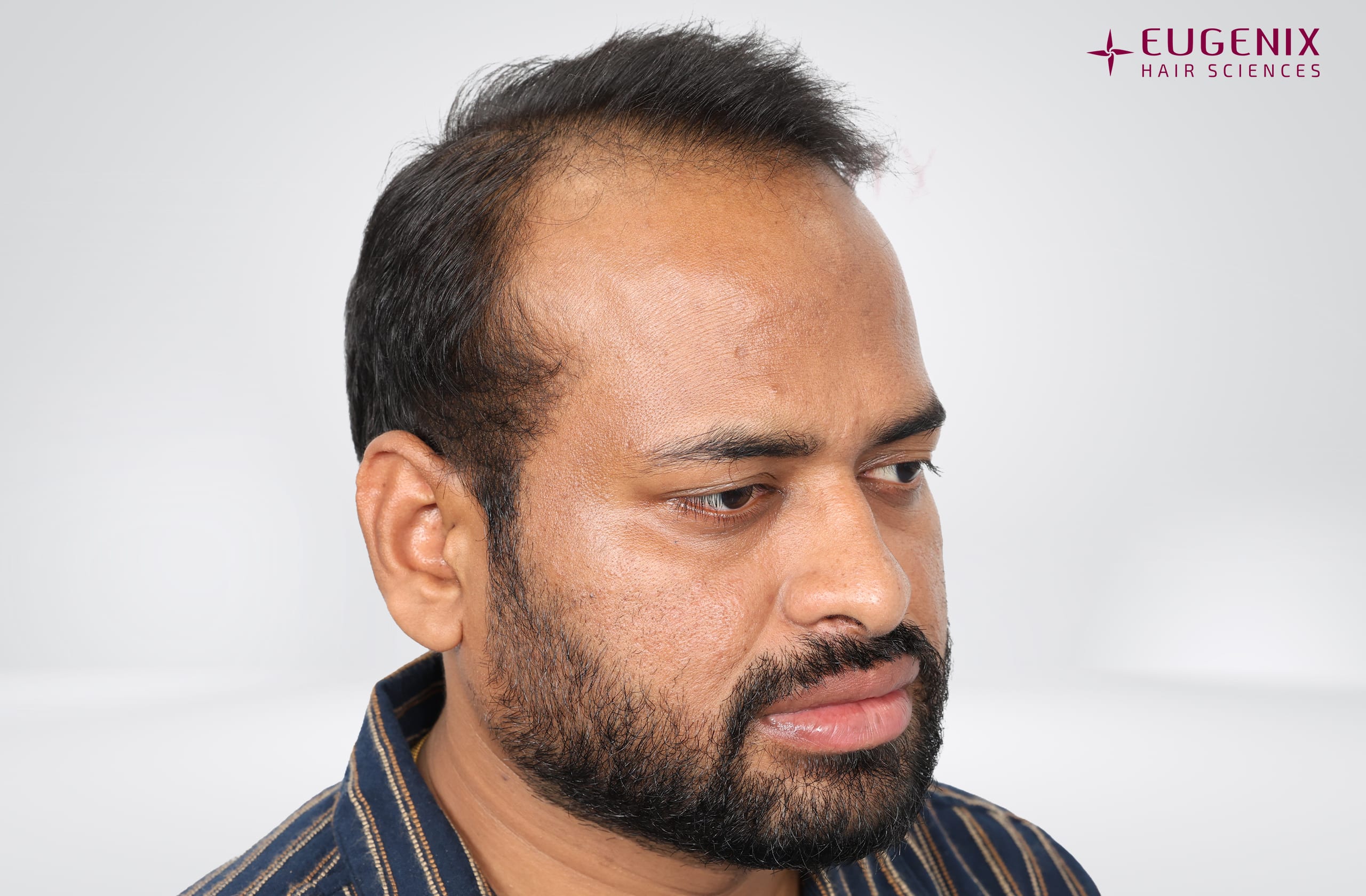 Kolanupaka Vishnu Vardhan Before Left copy