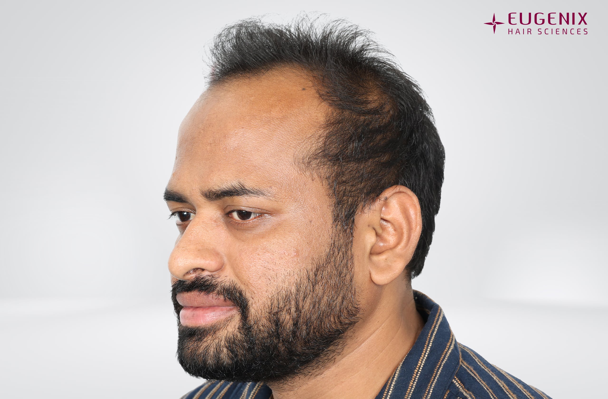 Kolanupaka Vishnu Vardhan Before Right copy