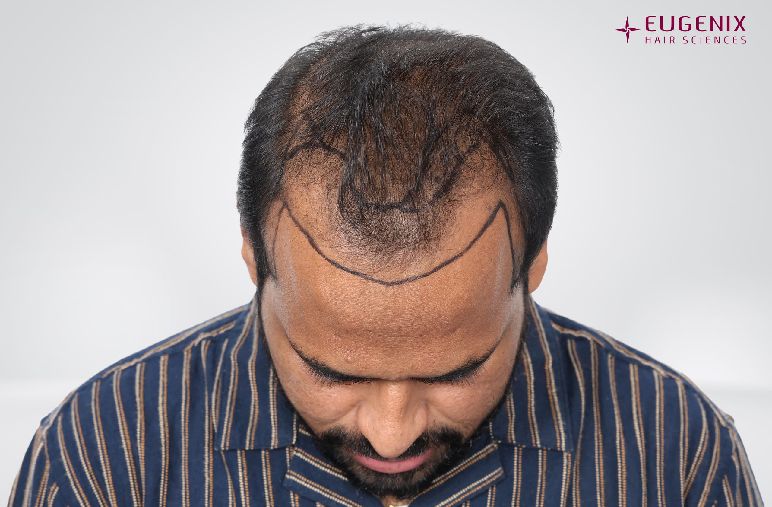 Kolanupaka Vishnu Vardhan Planning Head Down copy