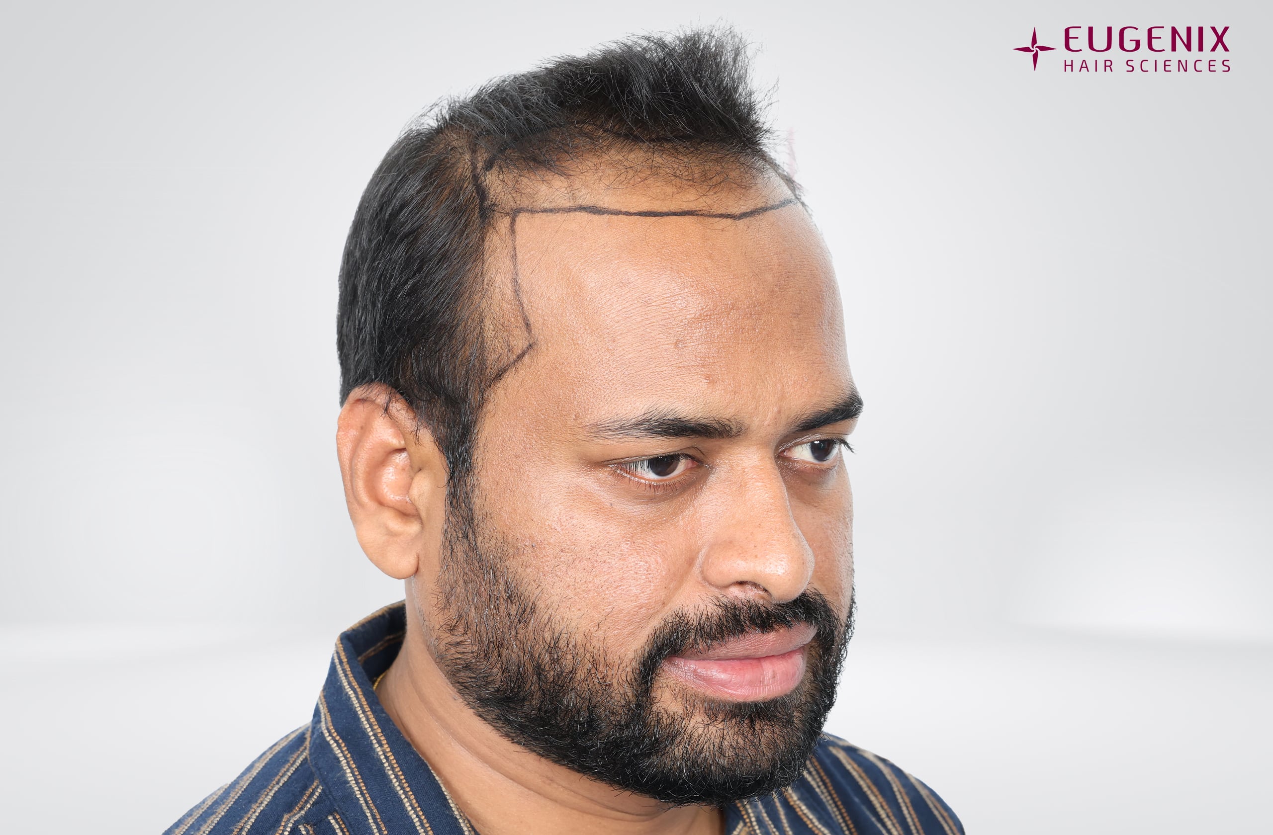 Kolanupaka Vishnu Vardhan Planning Left copy