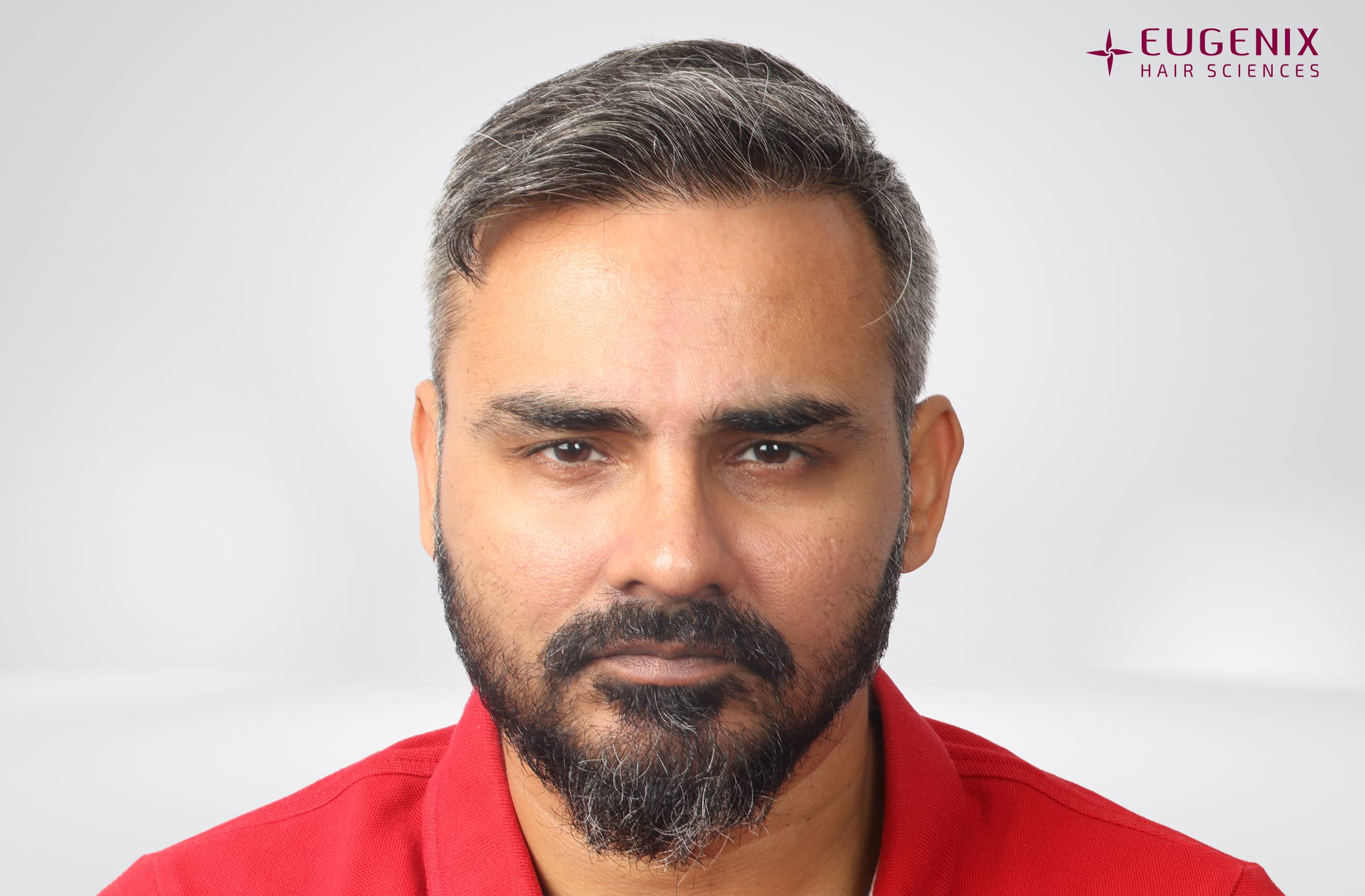 Nikhil Bir Singh Cheema After Front copy