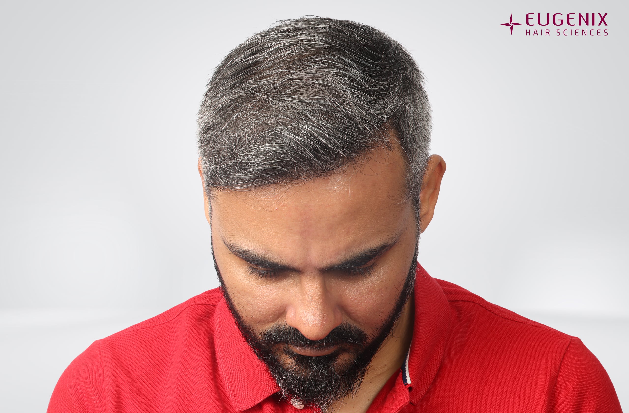 Nikhil Bir Singh Cheema After Head Down copy