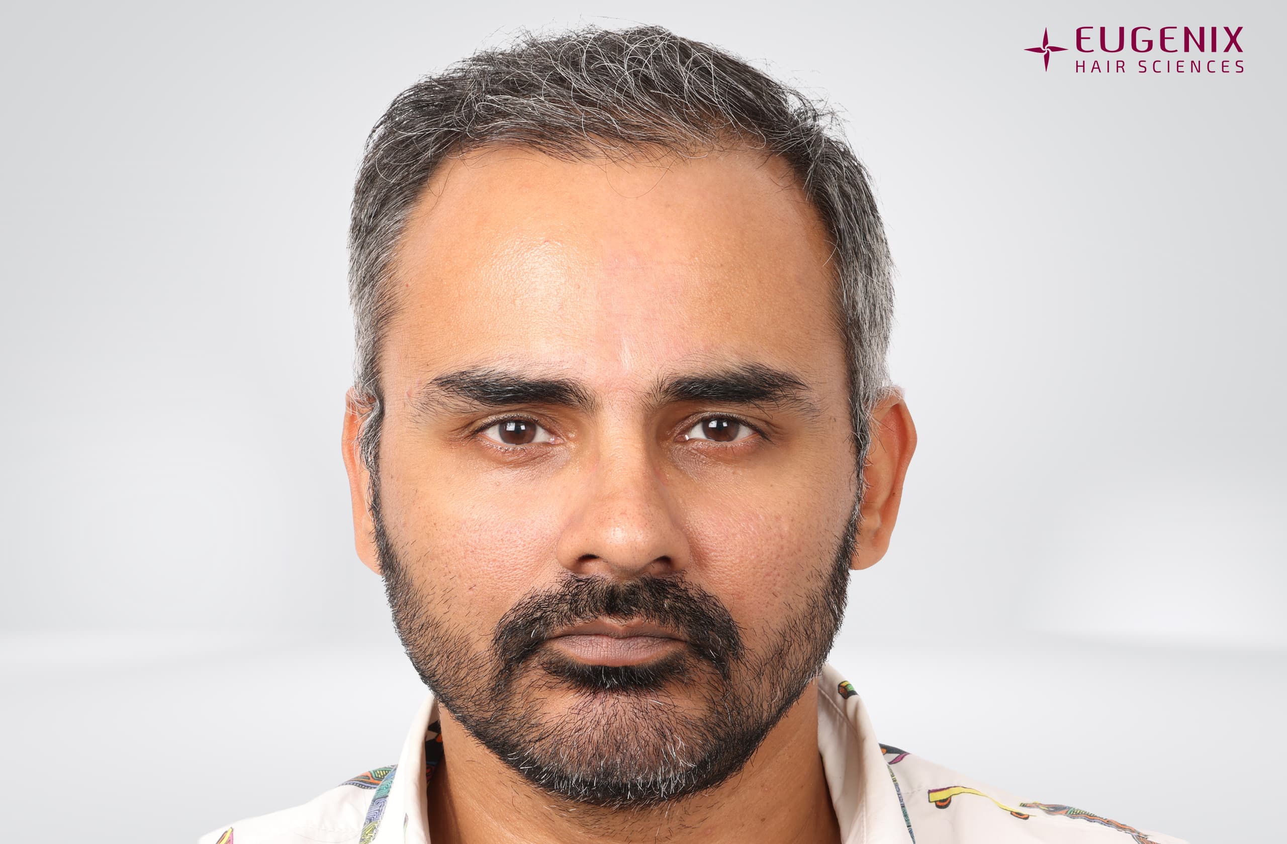 Nikhil Bir Singh Cheema Before Front copy