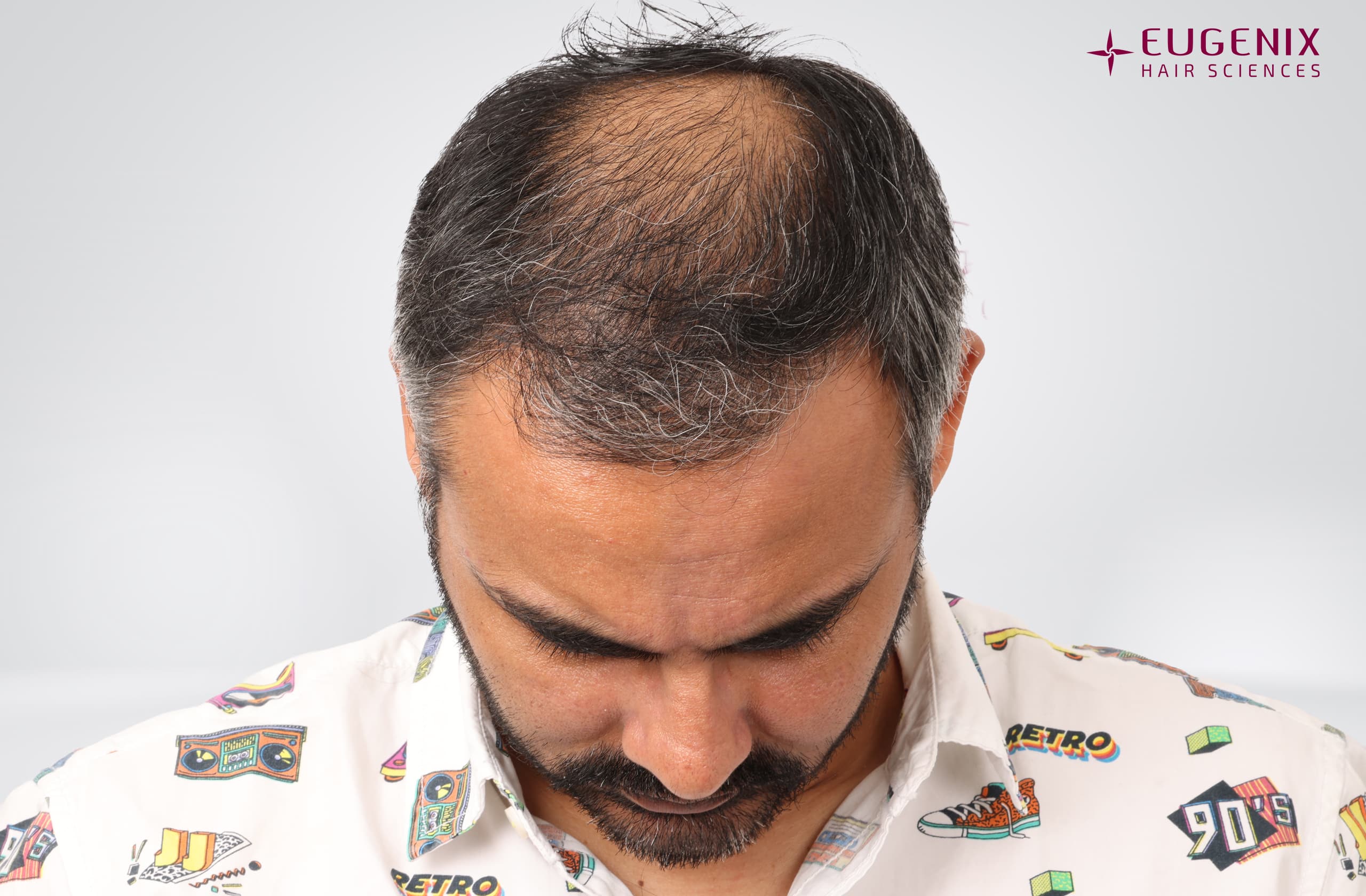 Nikhil Bir Singh Cheema Before Head Down copy