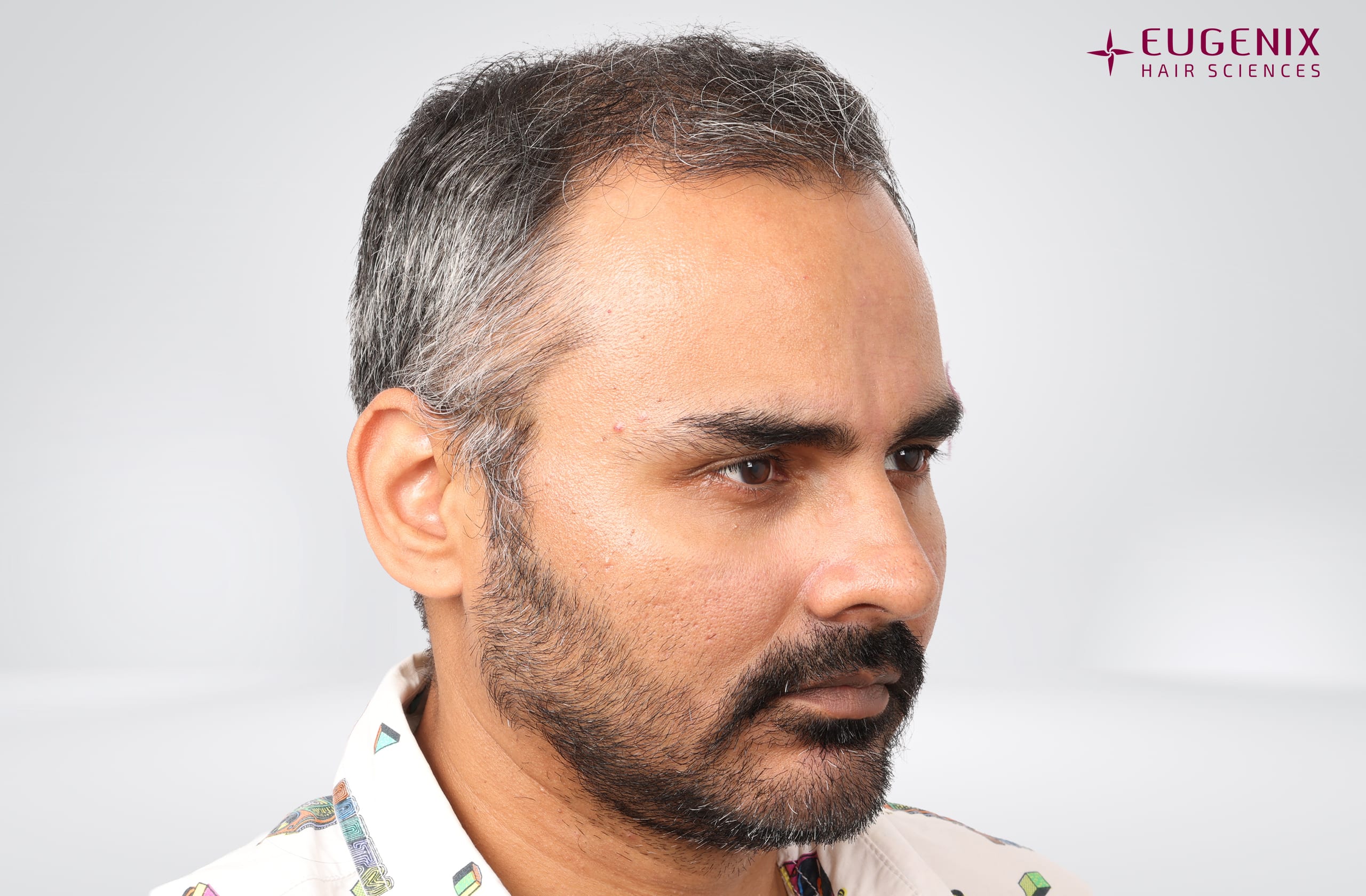 Nikhil Bir Singh Cheema Before Left copy