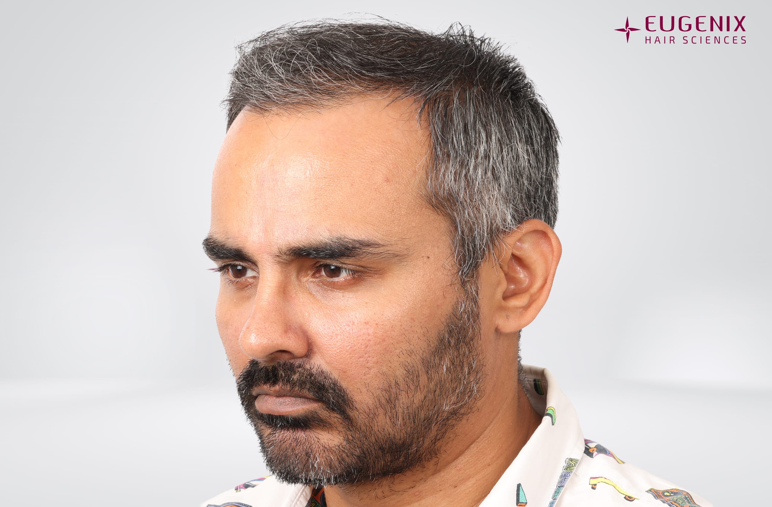 Nikhil Bir Singh Cheema Before Right copy