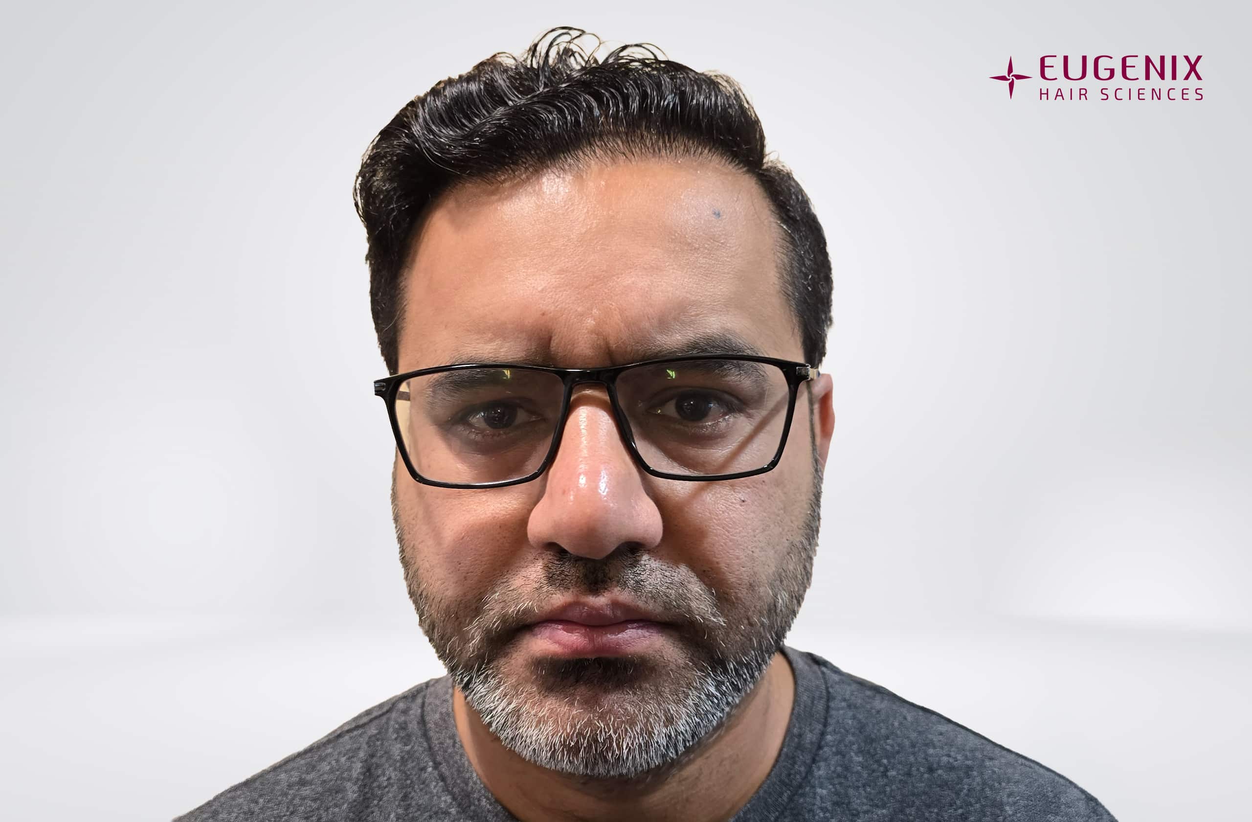 Saurabh Kaushish After Front copy