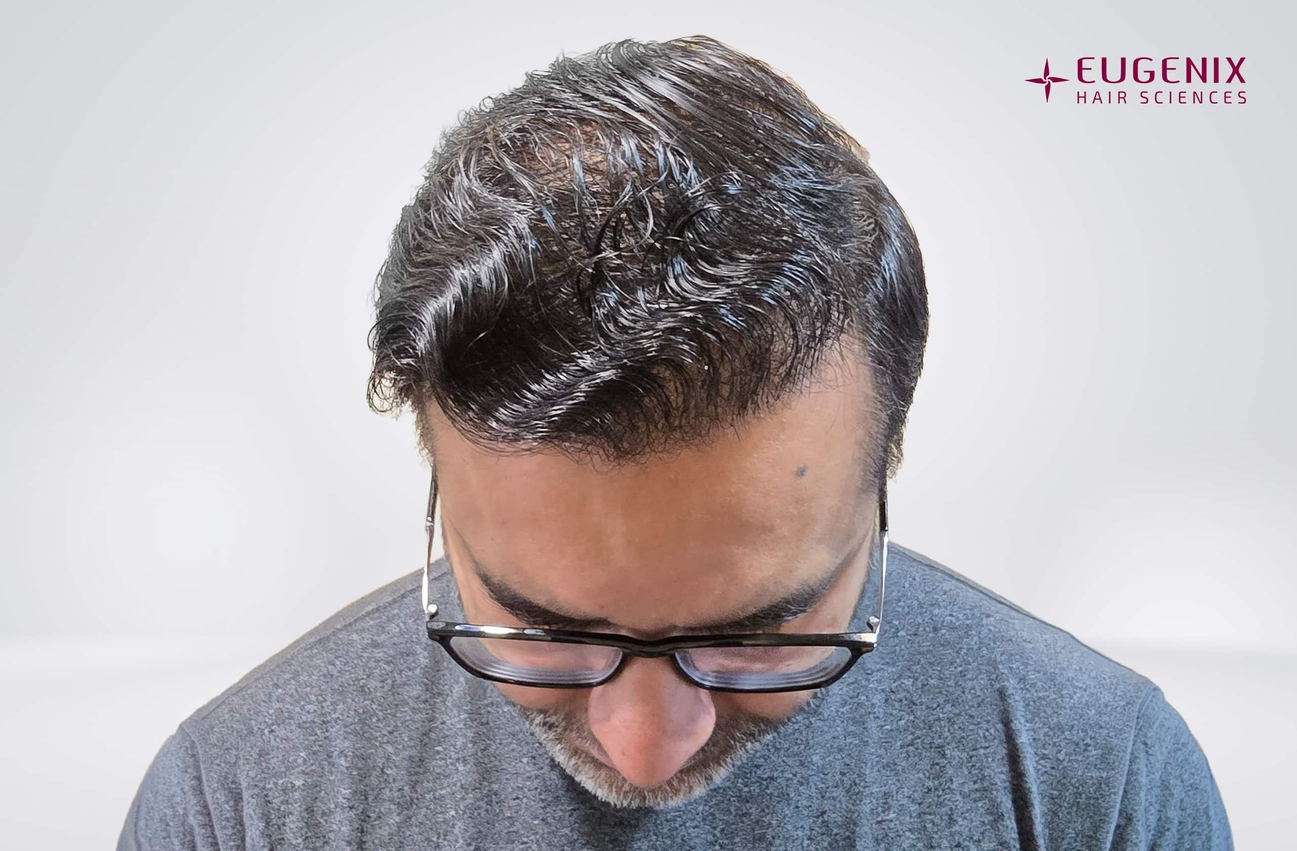 Saurabh Kaushish After Head Down copy