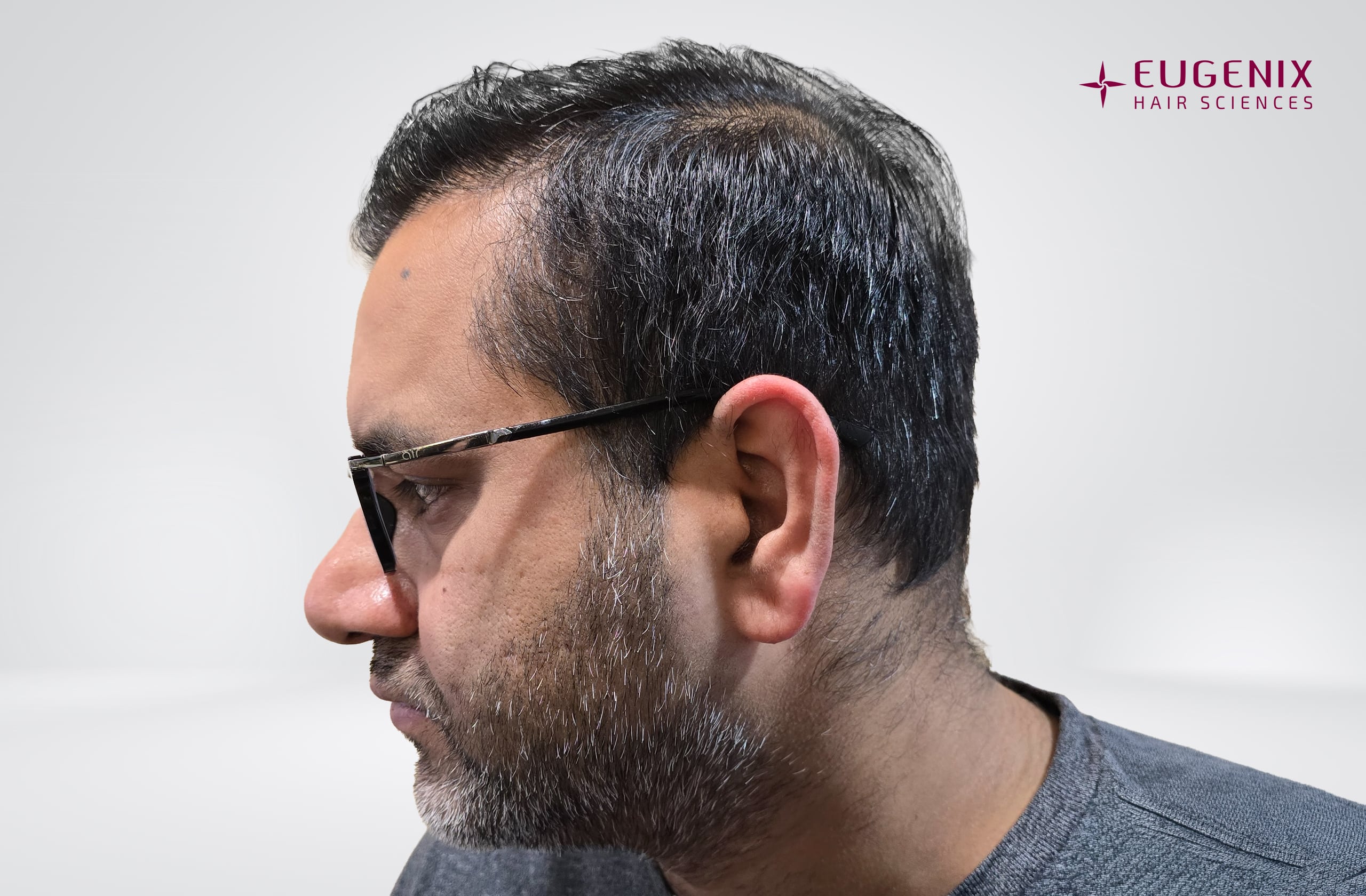 Saurabh Kaushish After Right copy