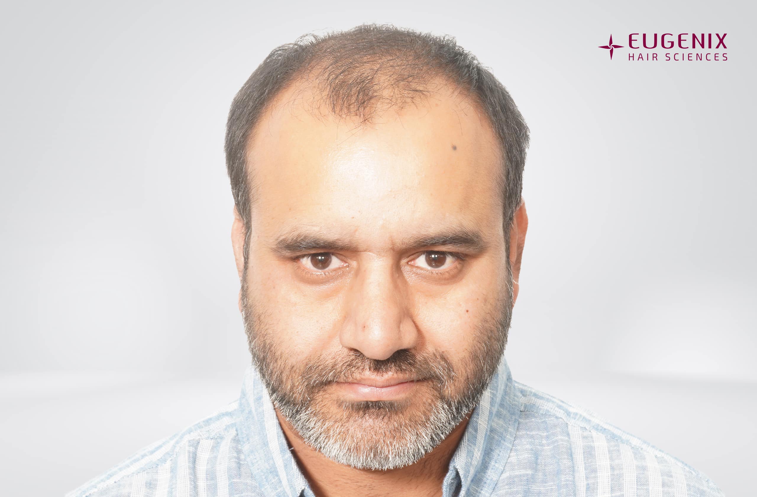 Saurabh Kaushish Before Front copy
