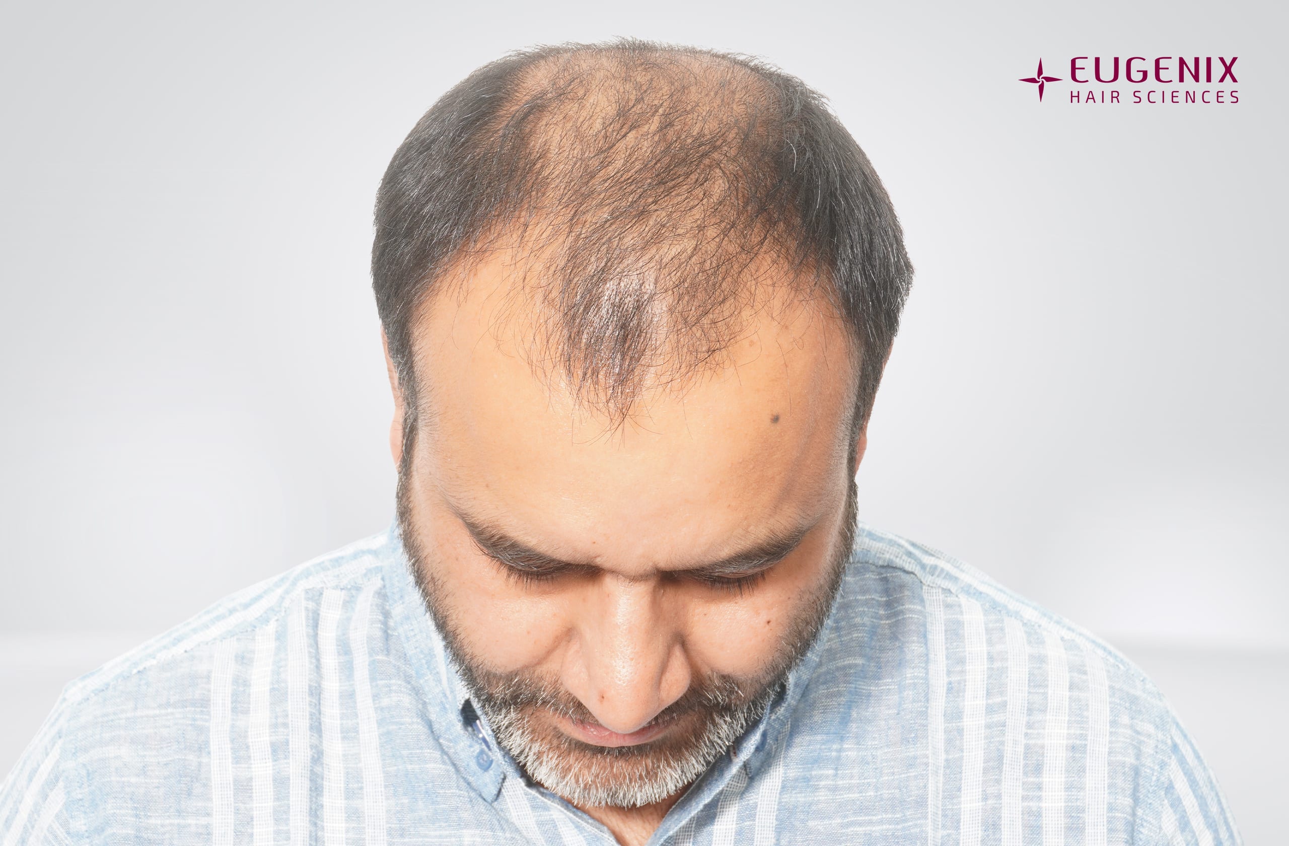 Saurabh Kaushish Before Head Down copy