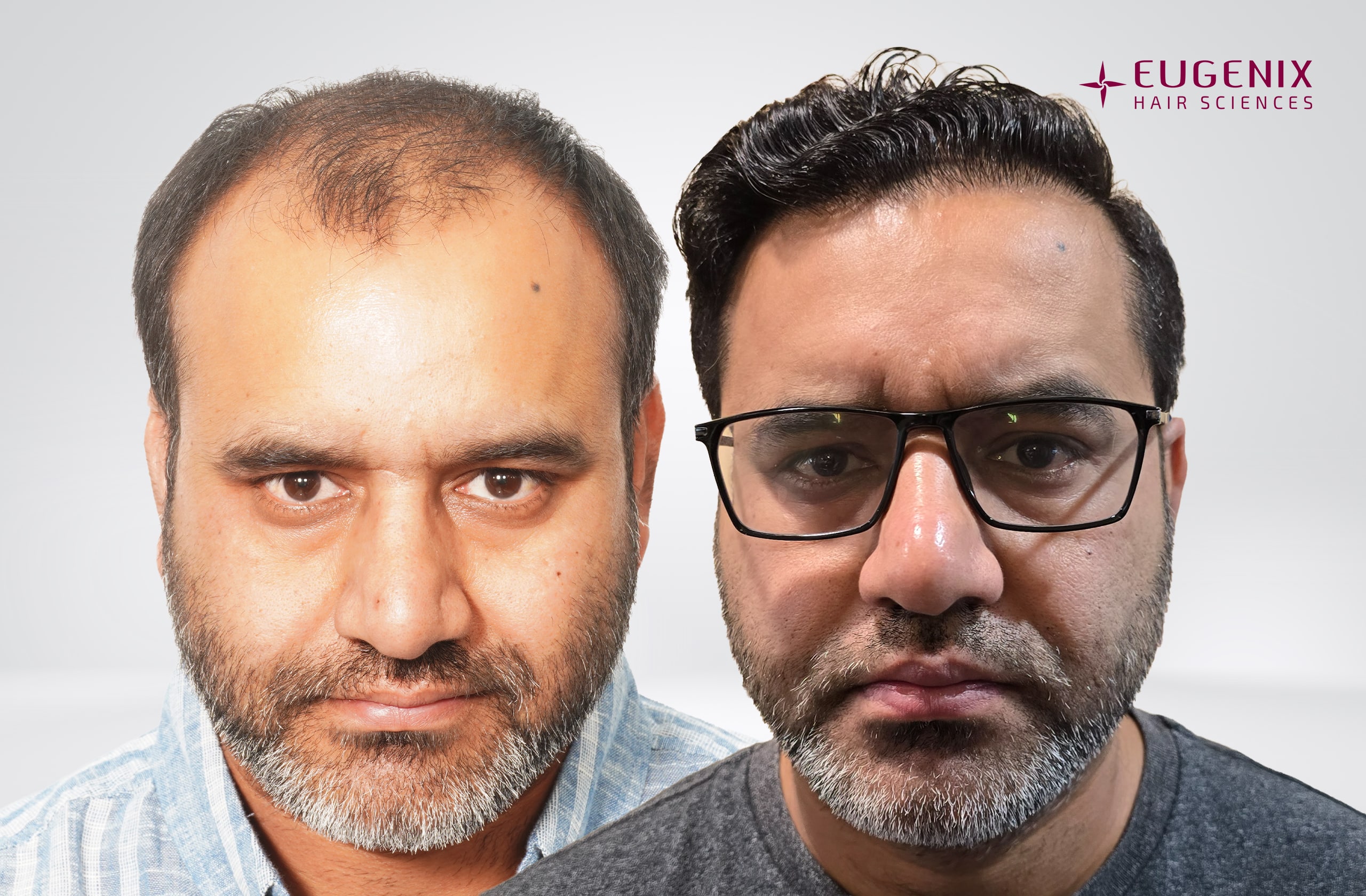 Saurabh Kaushish Before and After Front copy