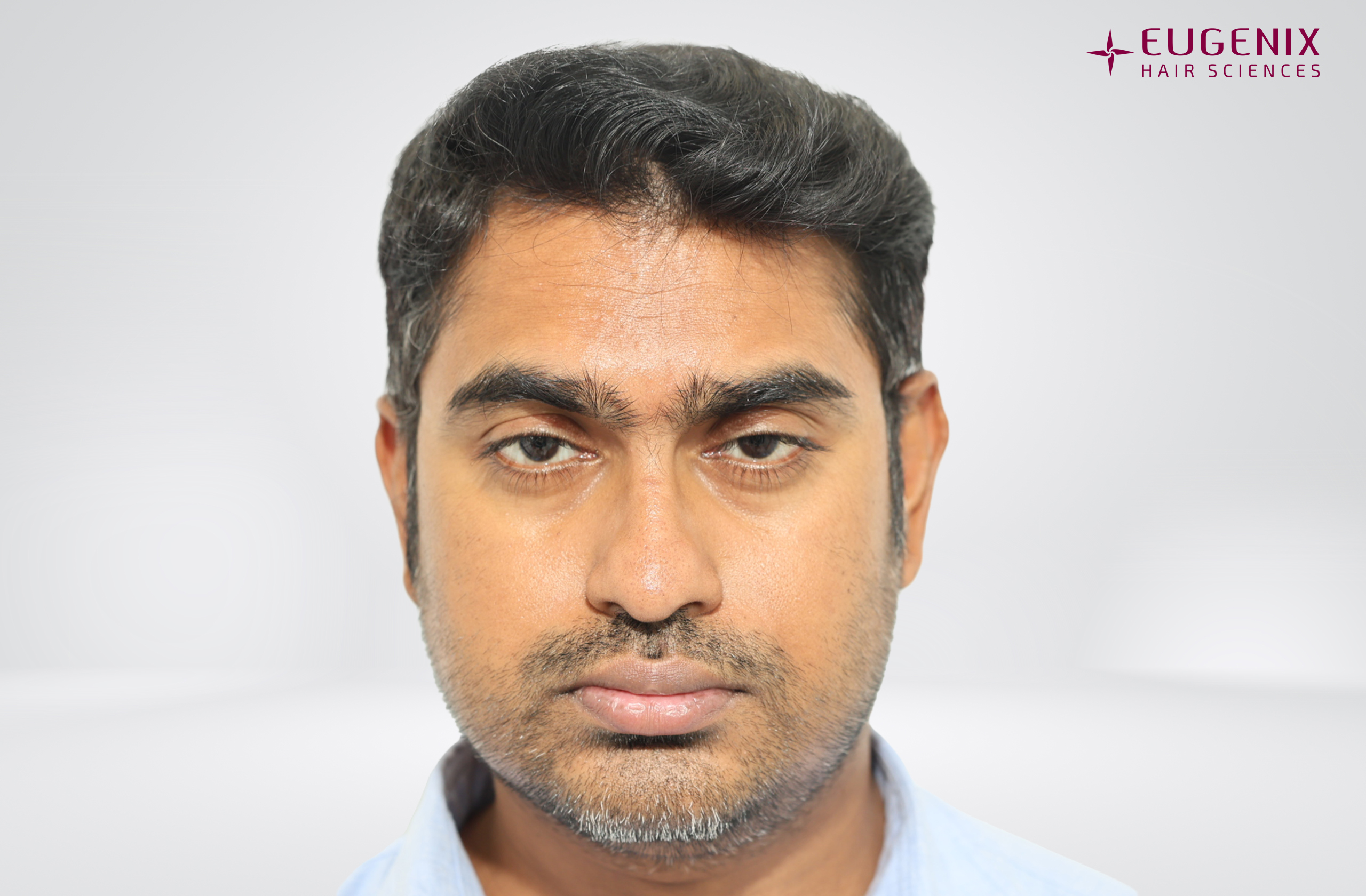 Vishal After Front copy