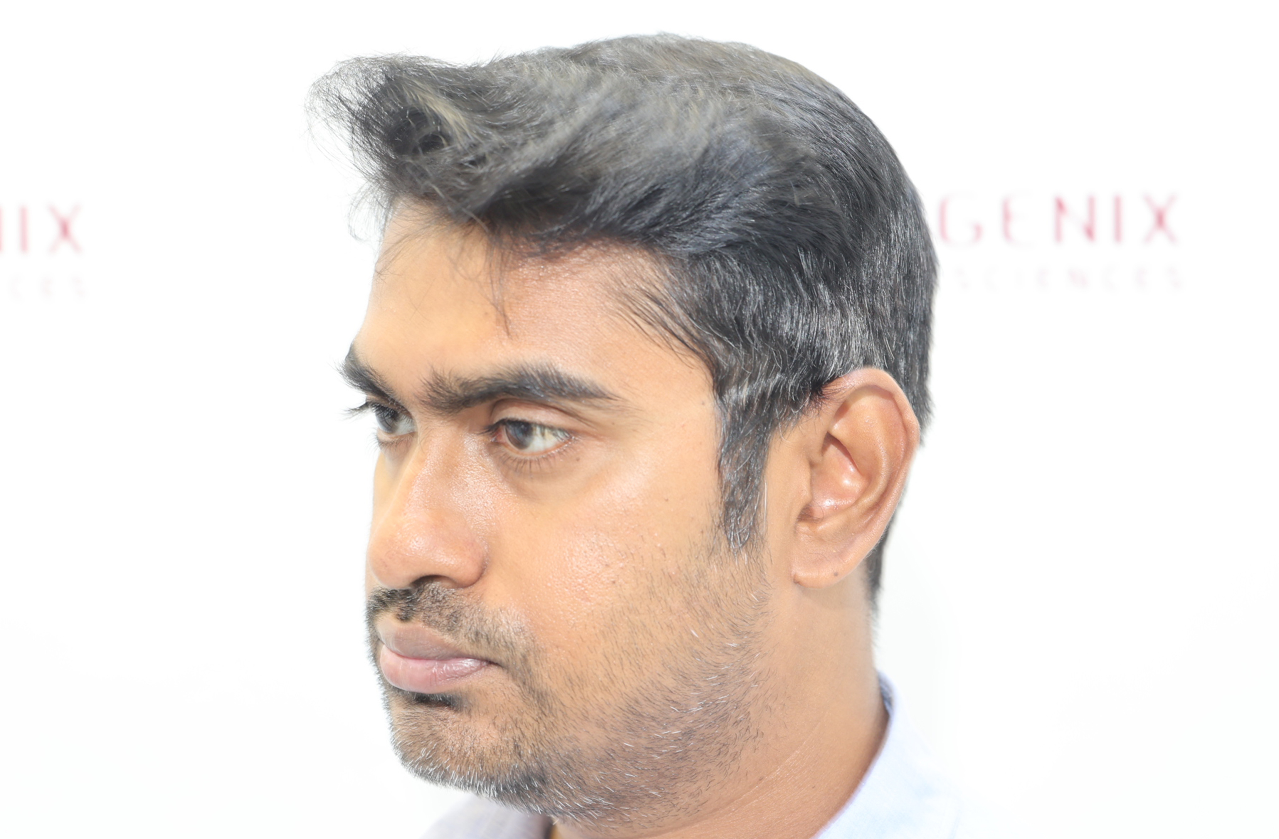 Vishal After Right copy