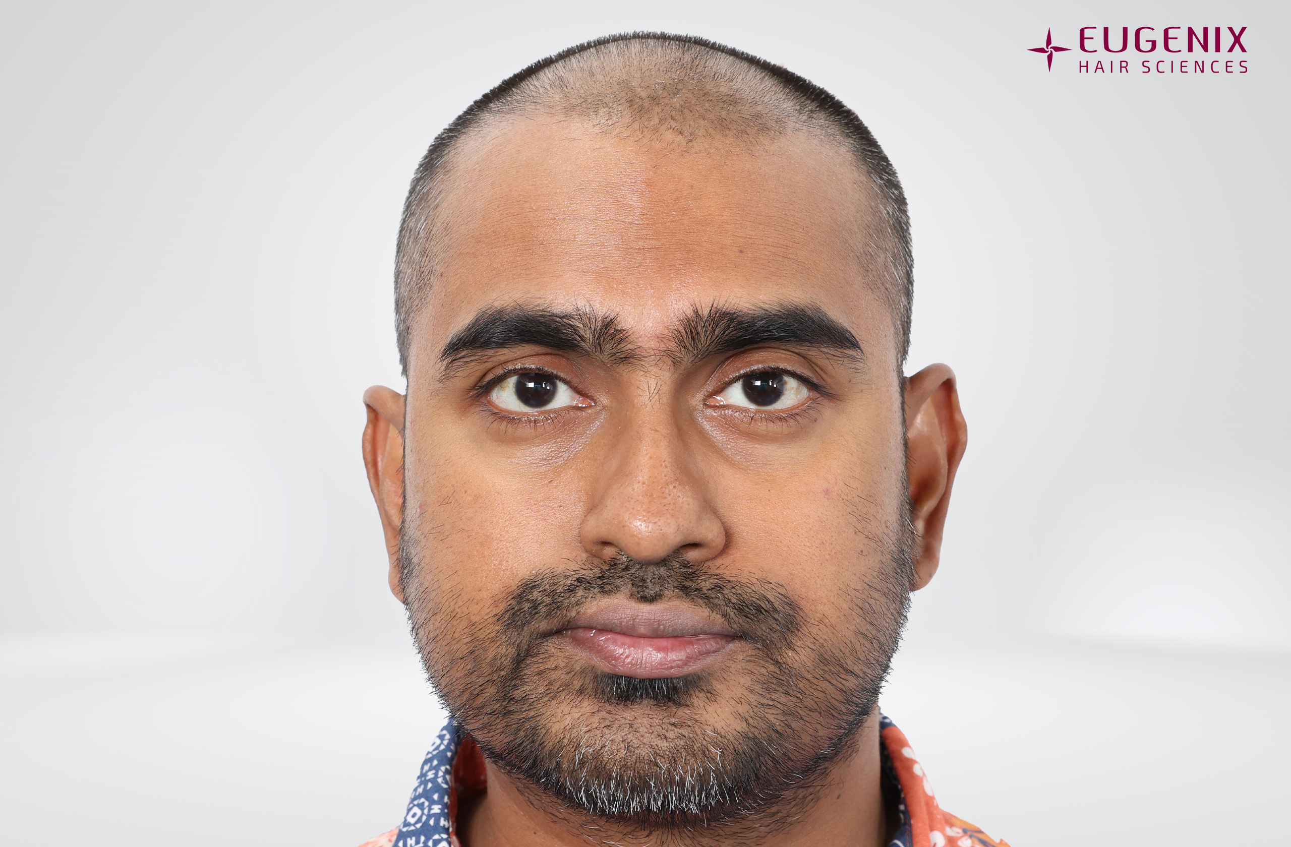 Vishal Before Front copy