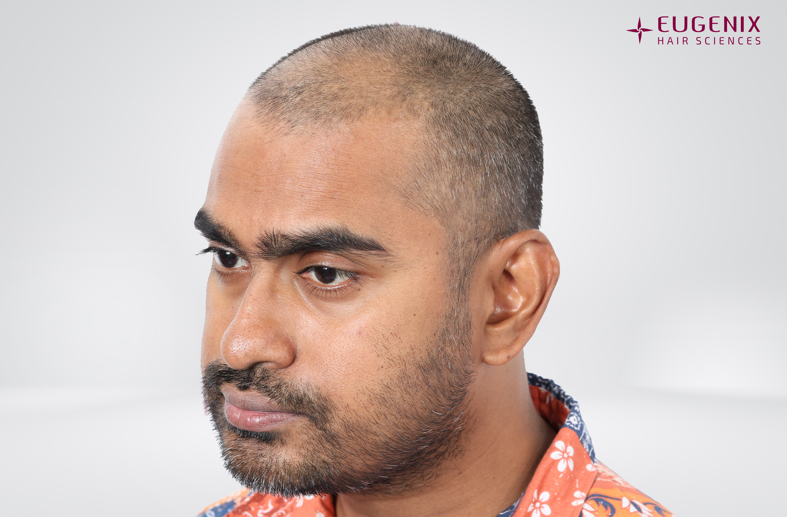 Vishal Before Right copy