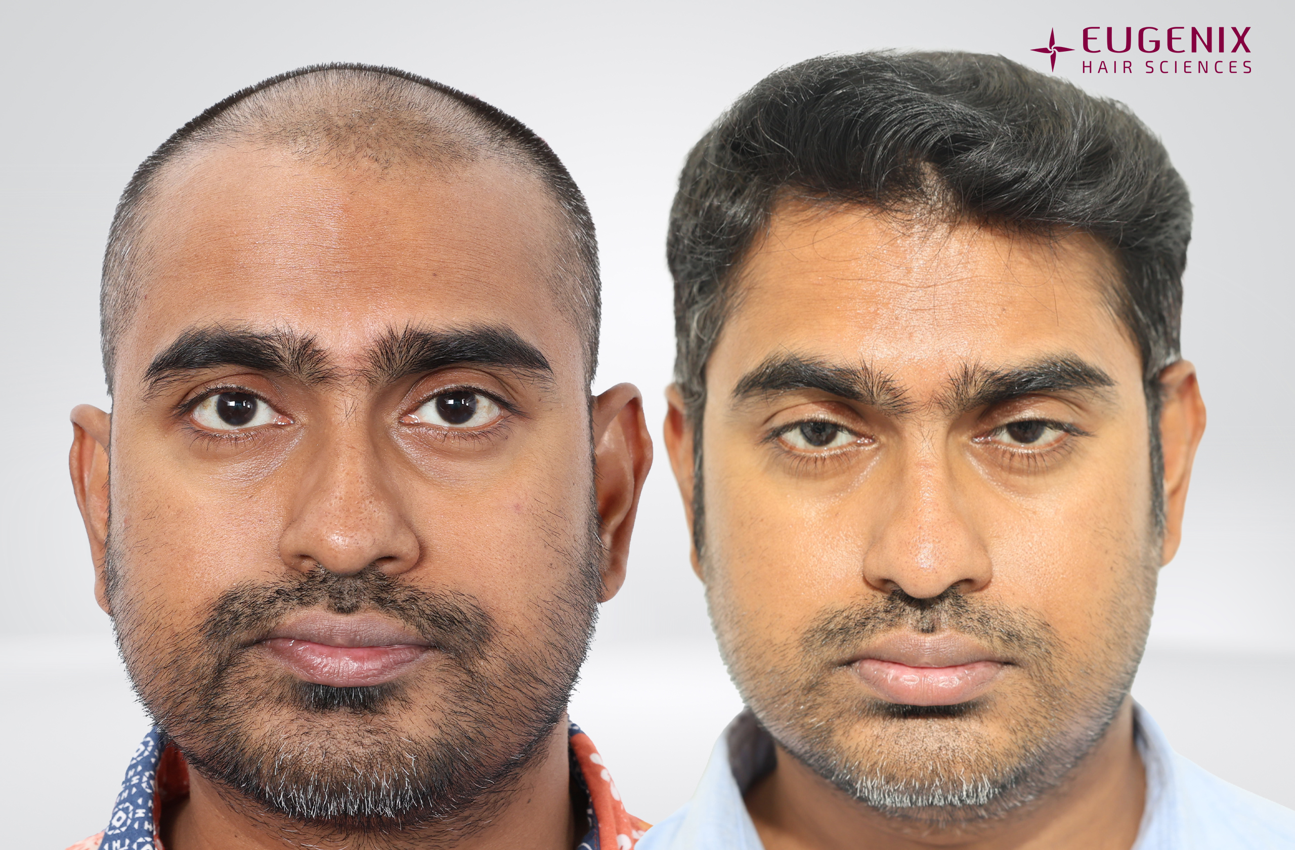 Vishal Before and After Front copy