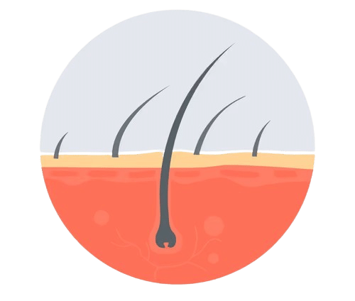 hair-transplant-icon-concept-vector-56658607-removebg-preview