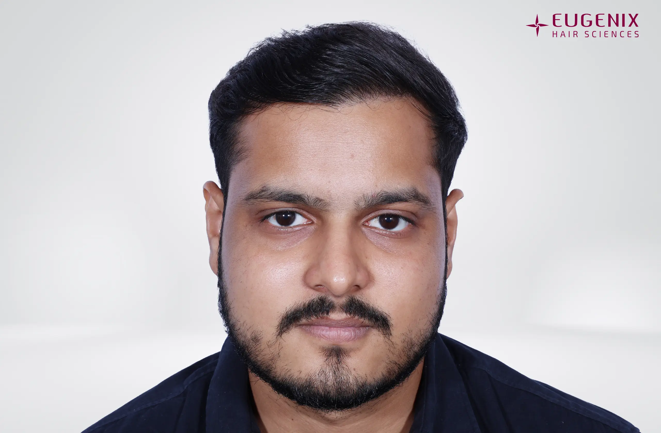 Abhay Khandloya After Front copy