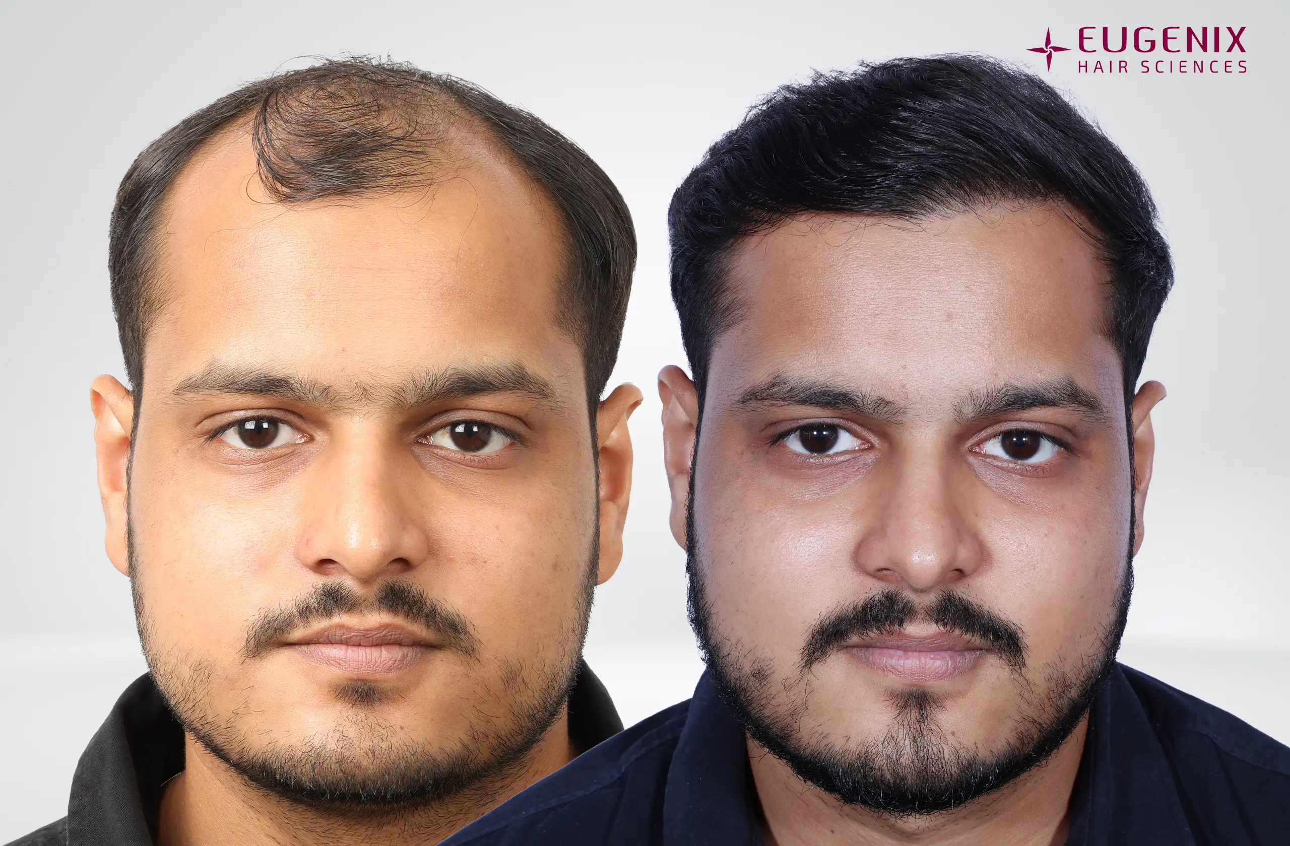 Abhay Khandloya Before & After Front copy