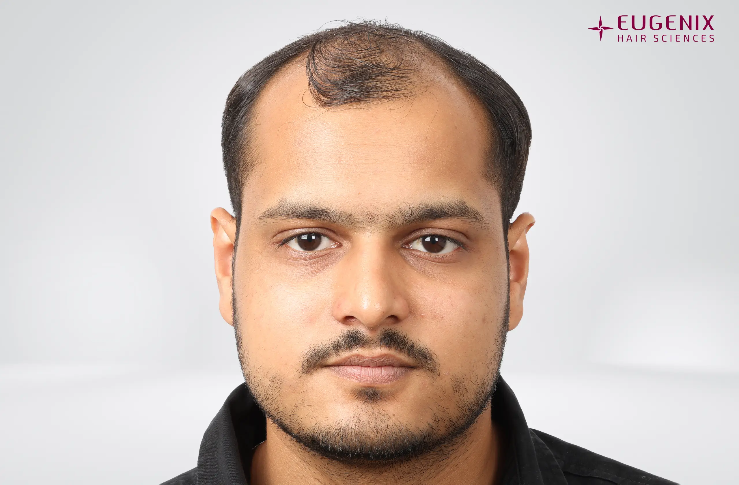 Abhay Khandloya Before Front copy
