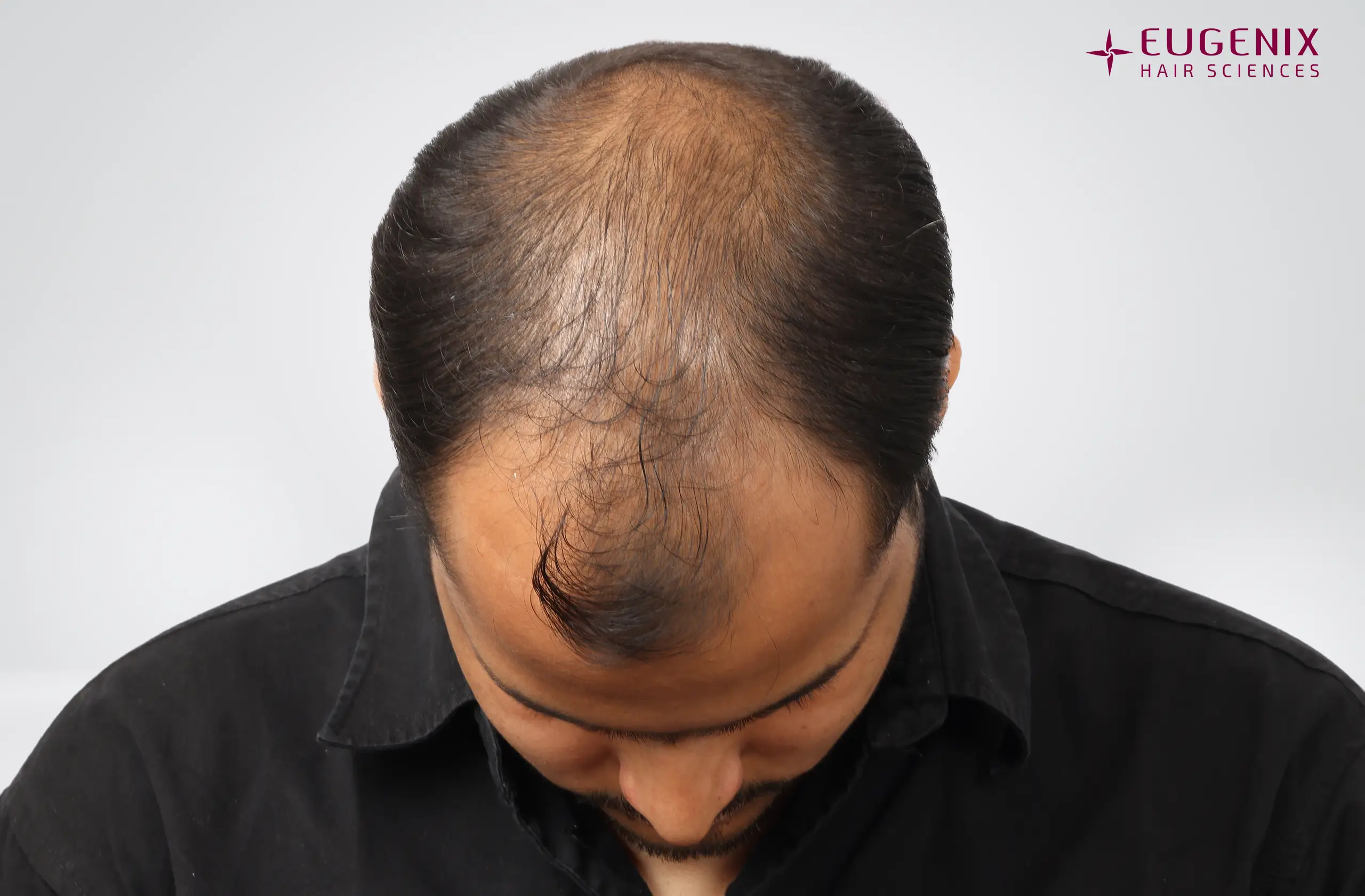 Abhay Khandloya Before Head Down copy