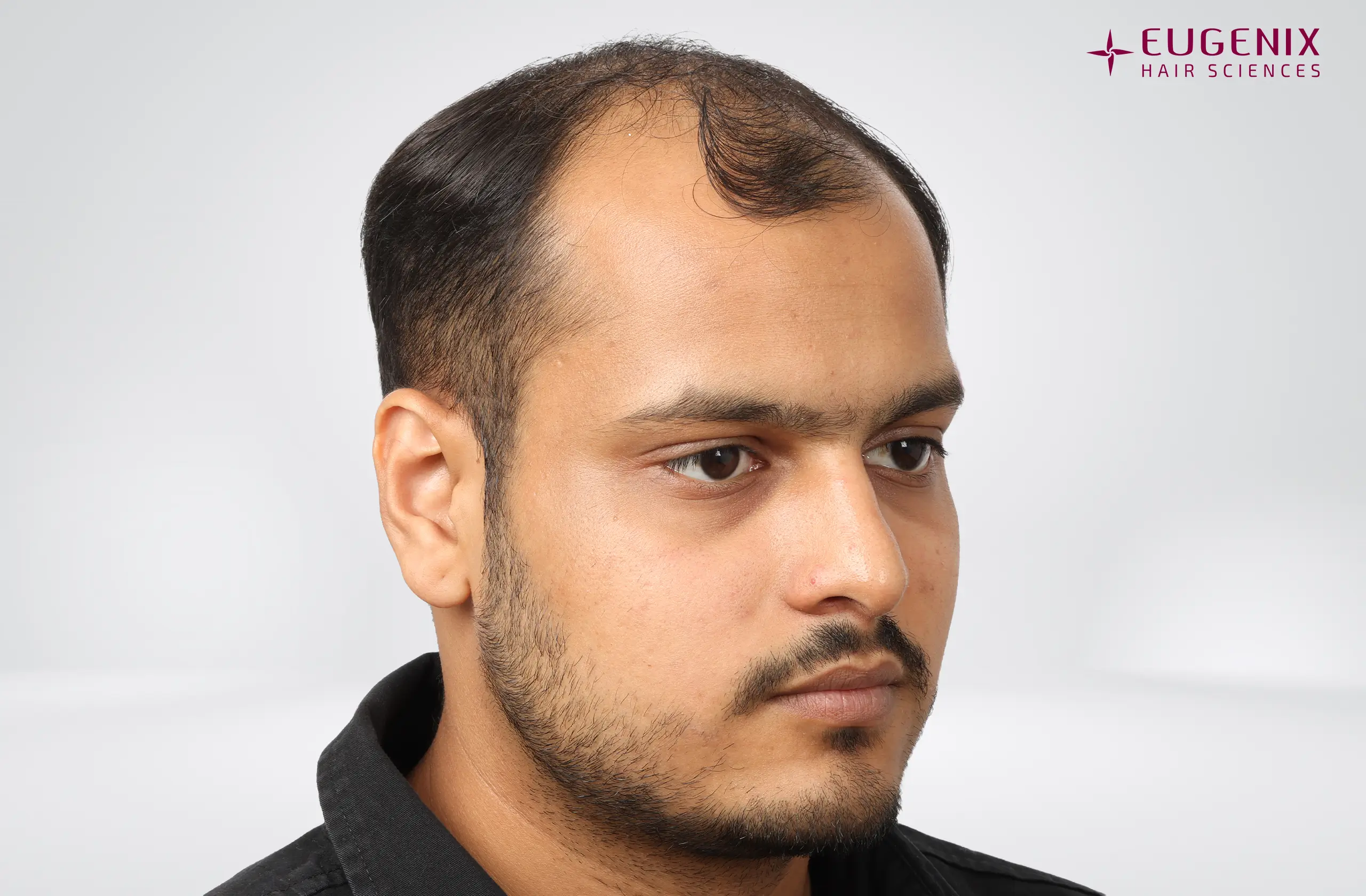 Abhay Khandloya Before Left copy