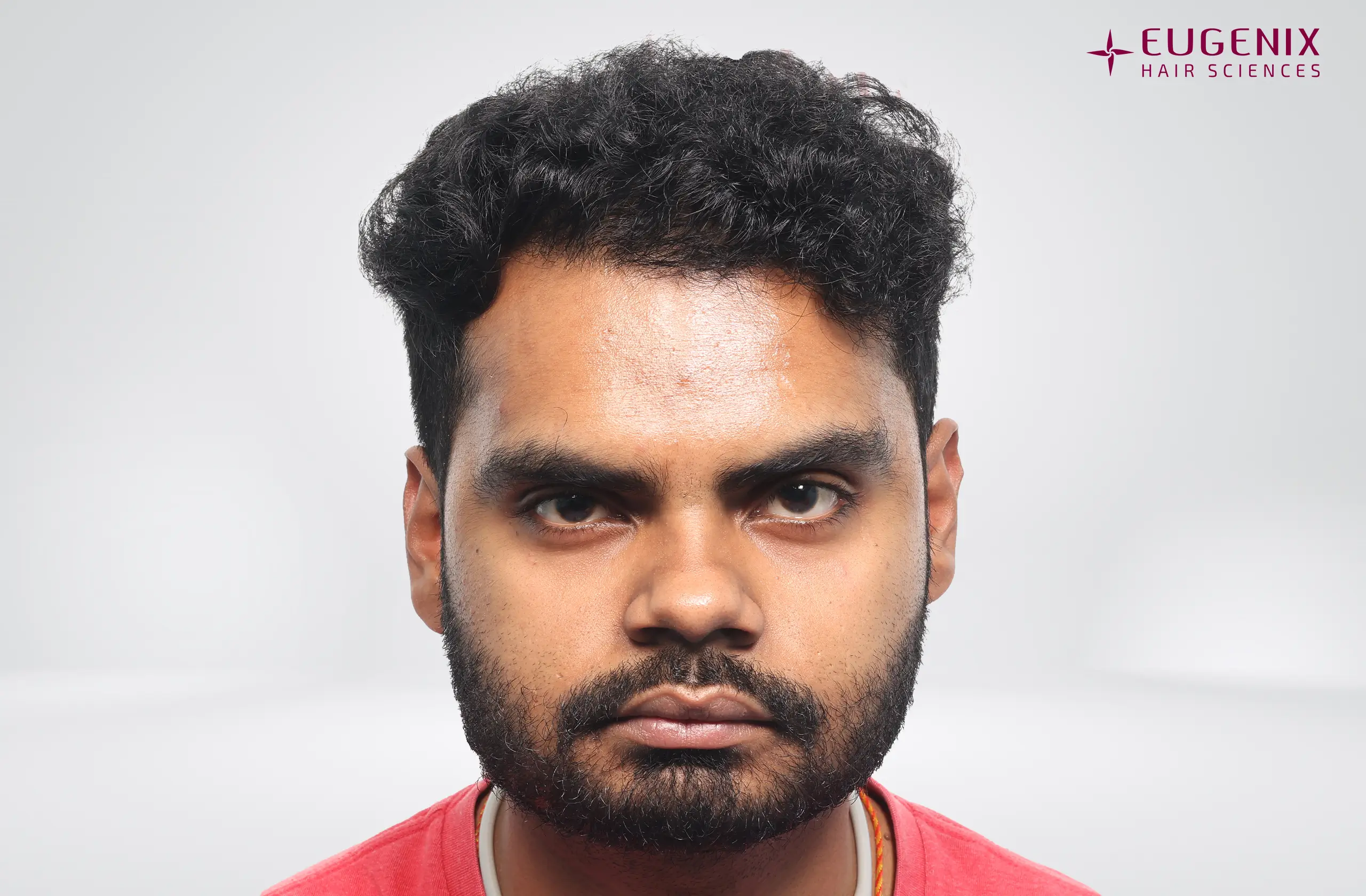 Apporv Jha After Front copy